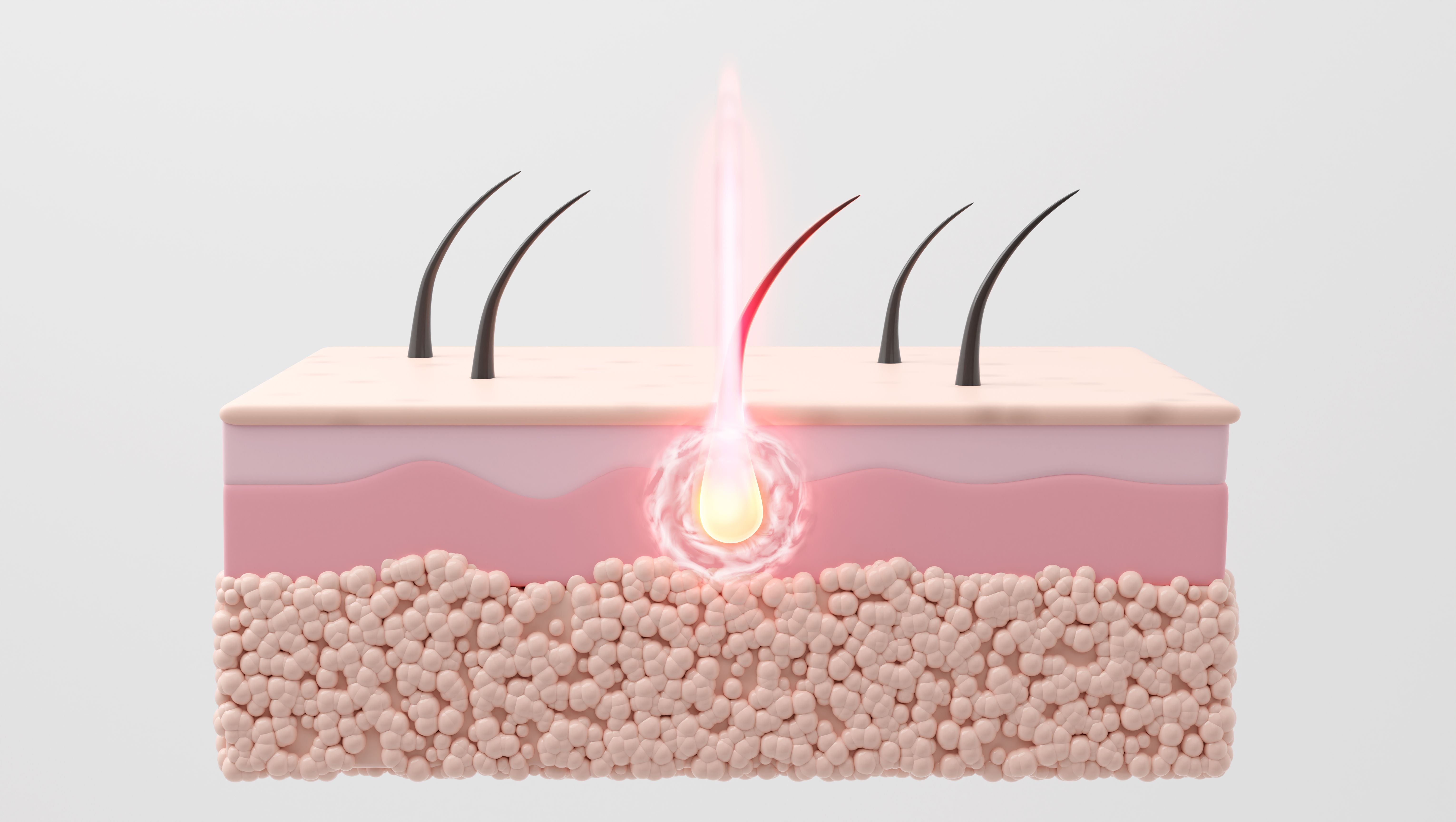 laser treatment skin