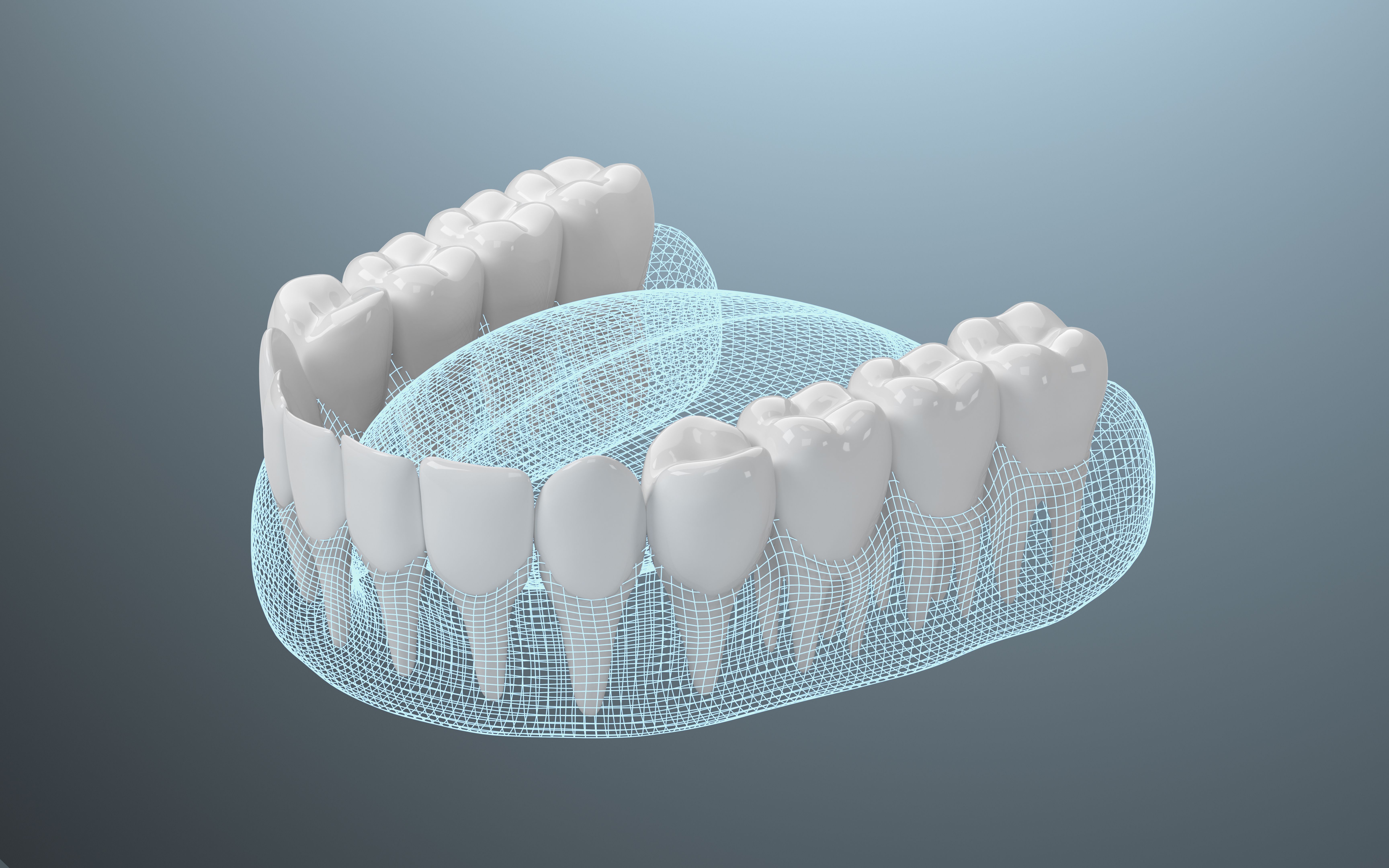 3d model dental
