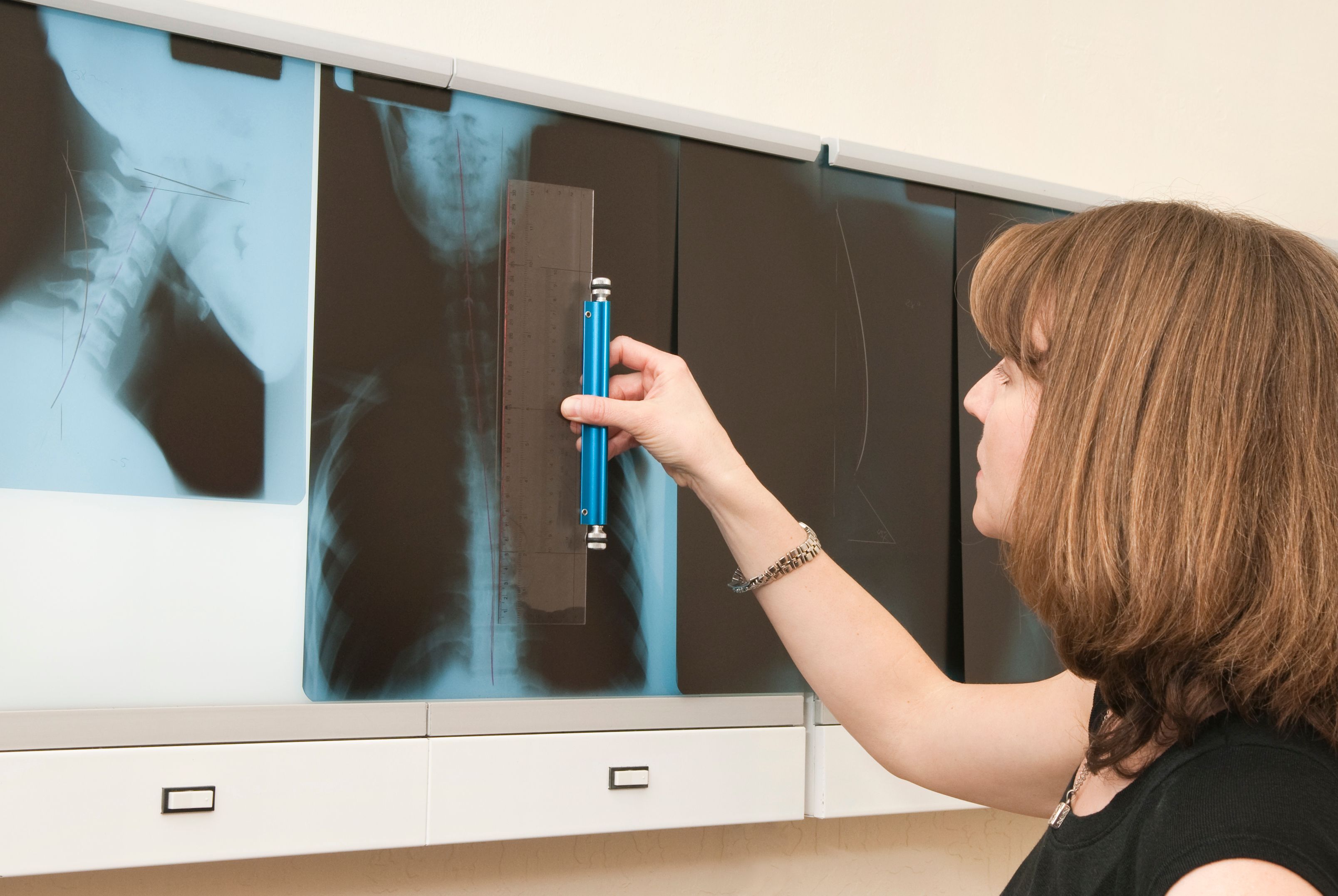 Revisão de raios-X do paciente quiroprático Series