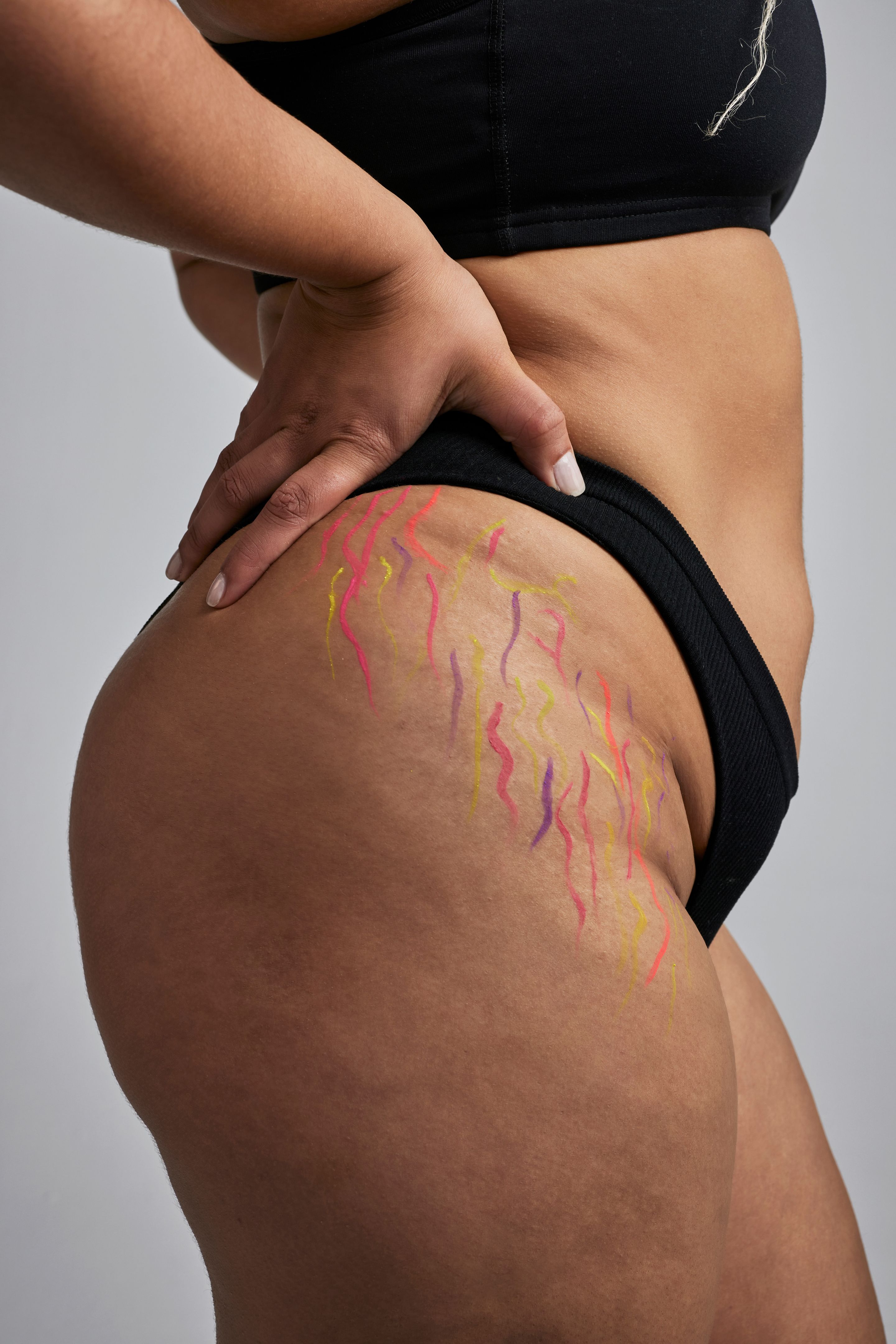 Studio, body and stretch marks of a plus size woman with underwear, thigh and creative art. Model person closeup for natural skin, cellulite and inclusive lingerie or acceptance on grey background