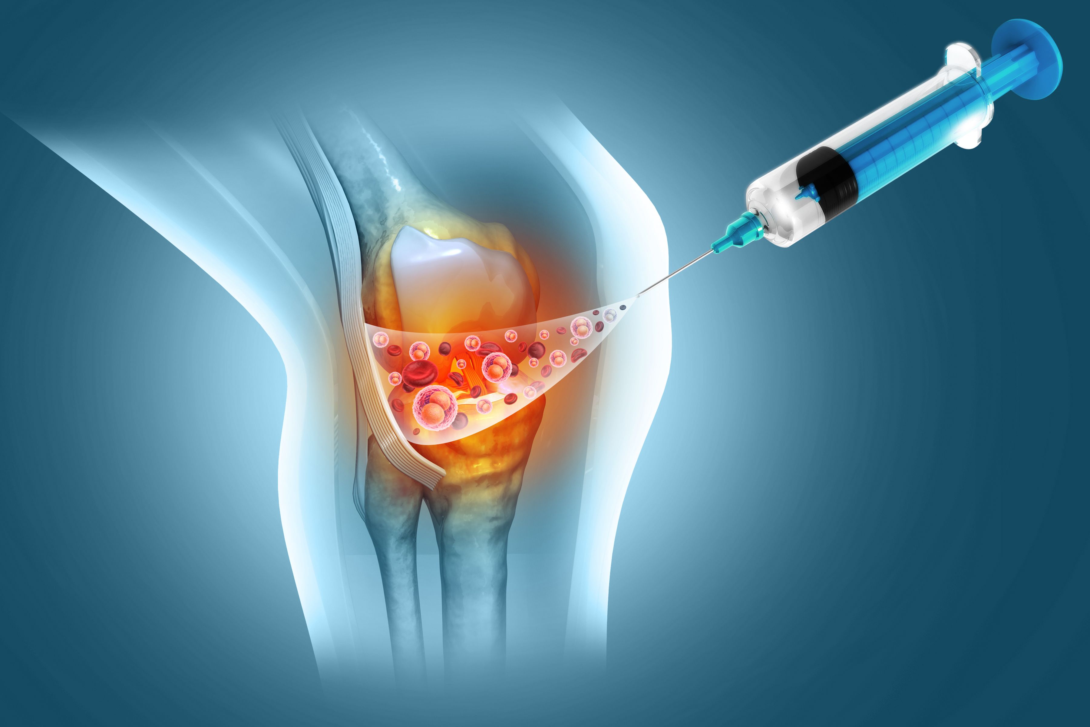 regenerative therapy