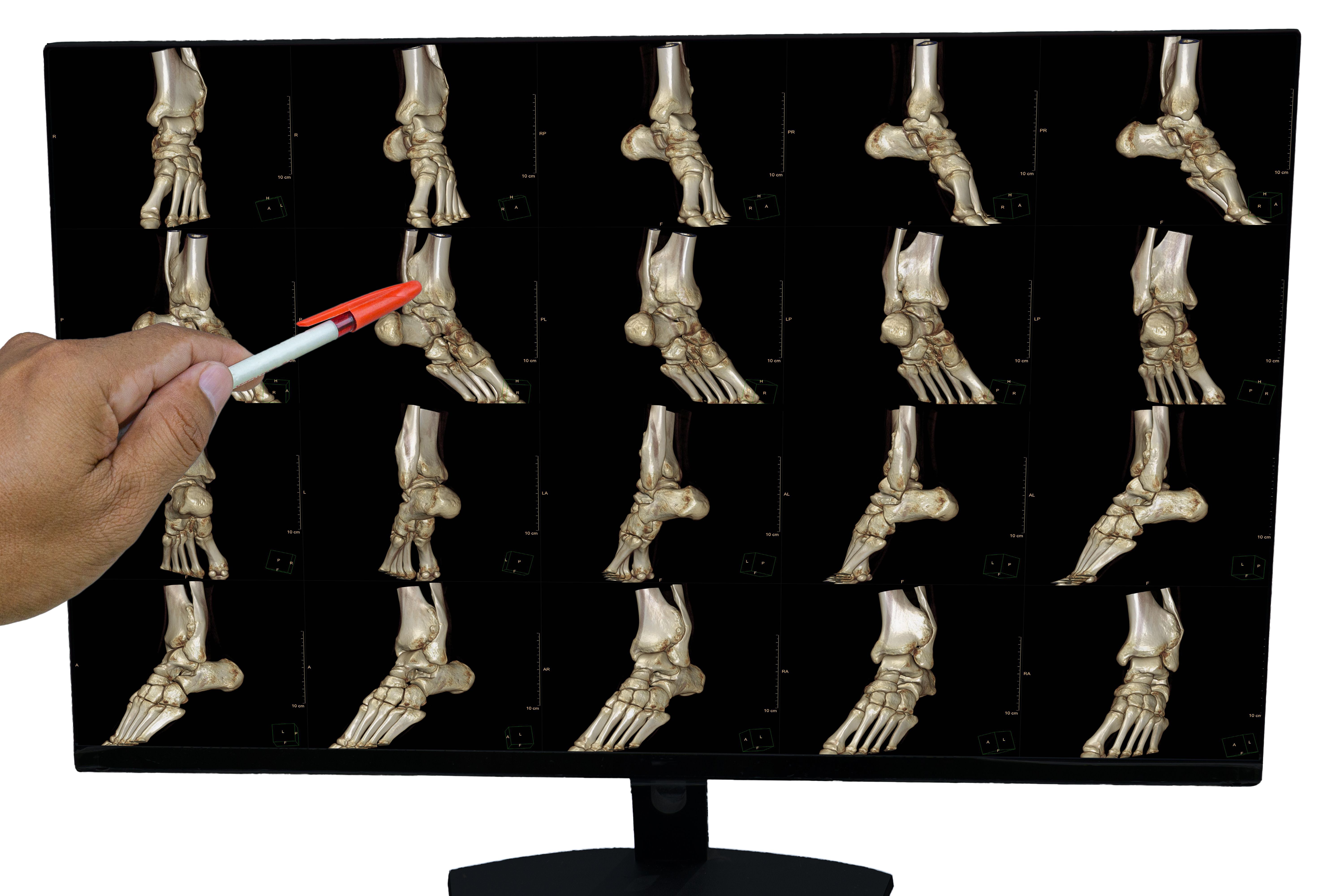 trauma informed care