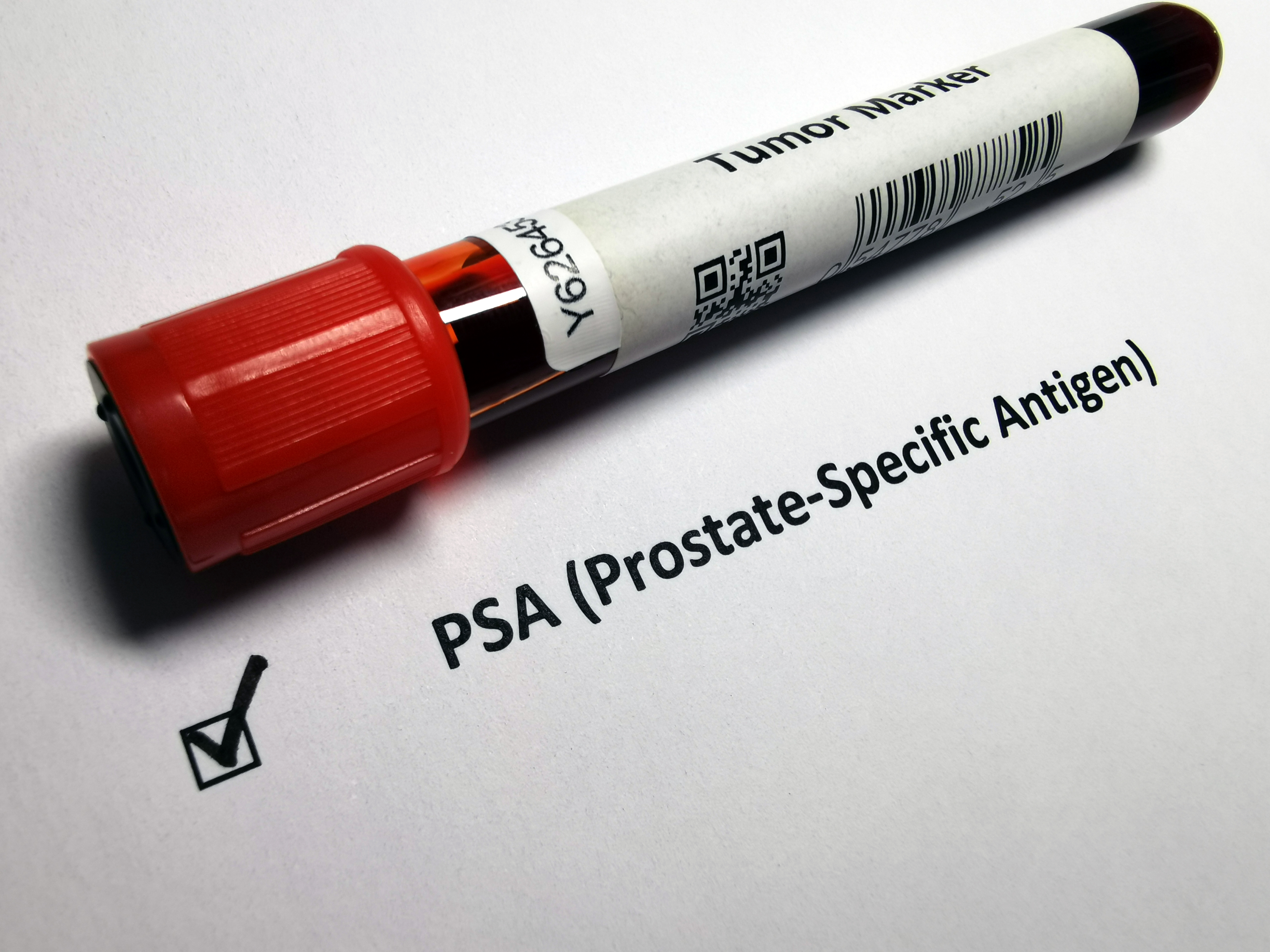 Tumor marker for PSA (Prostate-Specific Antigen) Tumor marker for PSA (Prostate-Specific Antigen)