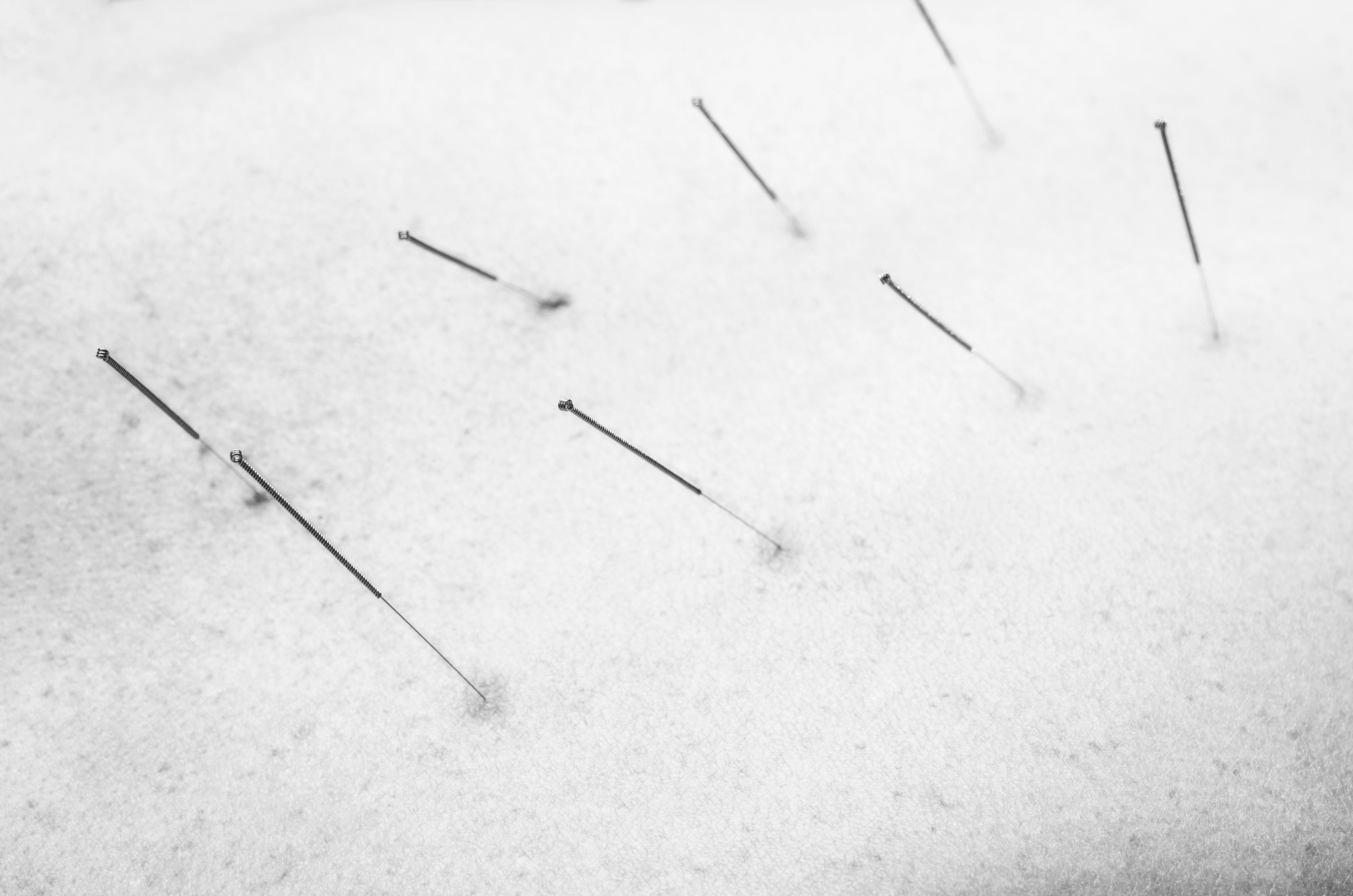 winter sports acupuncture