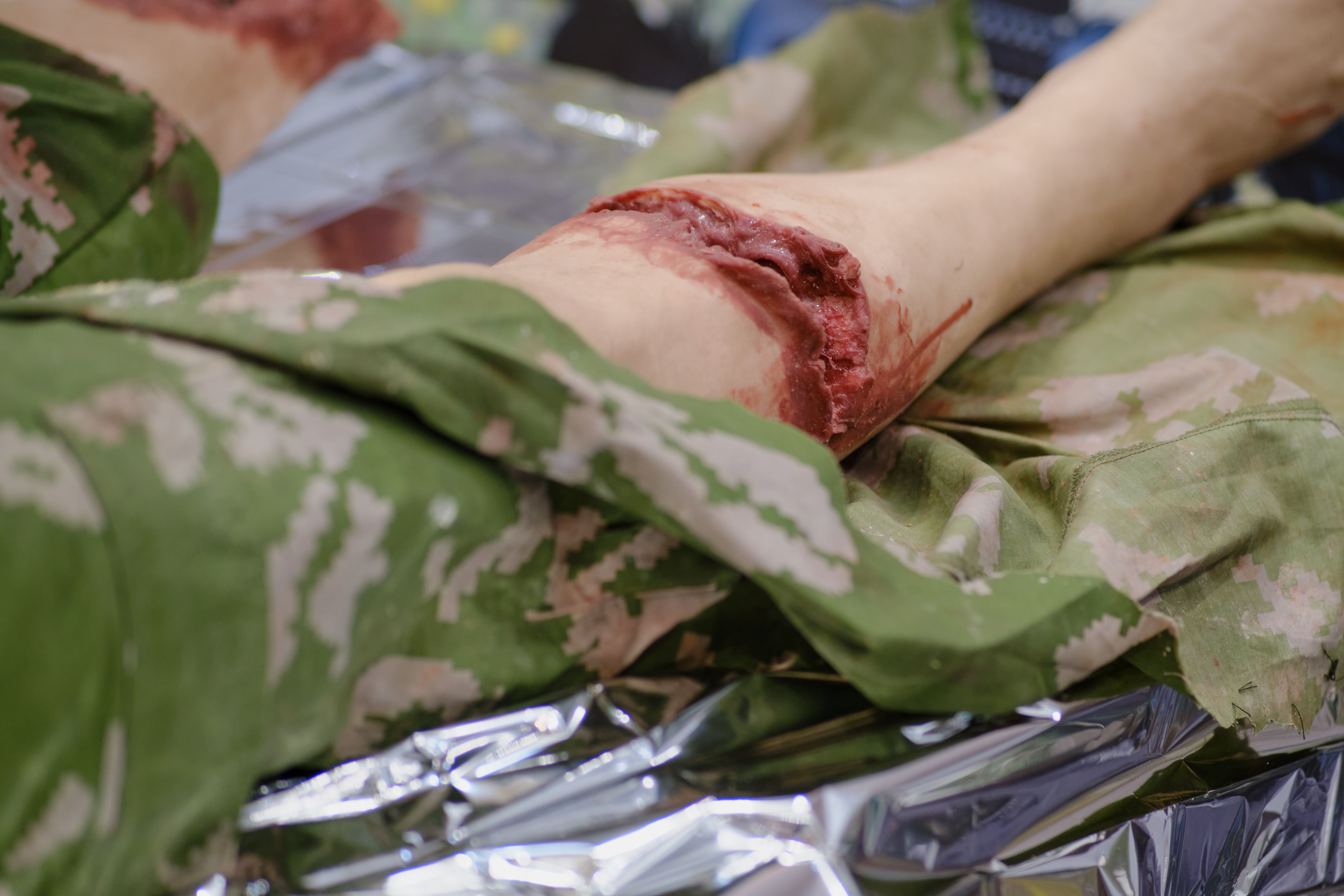 trauma scene technician