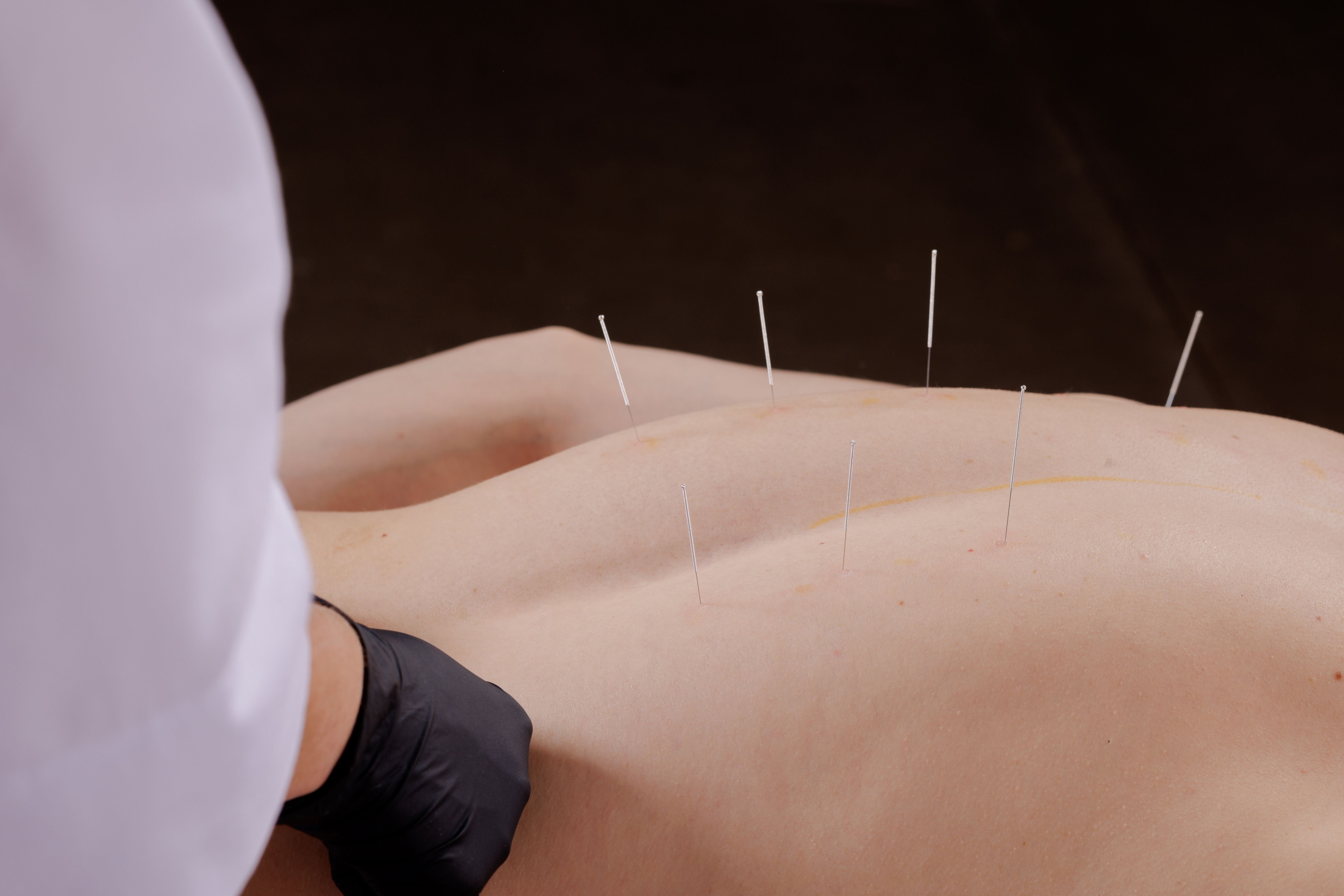 acupuncture practitioner