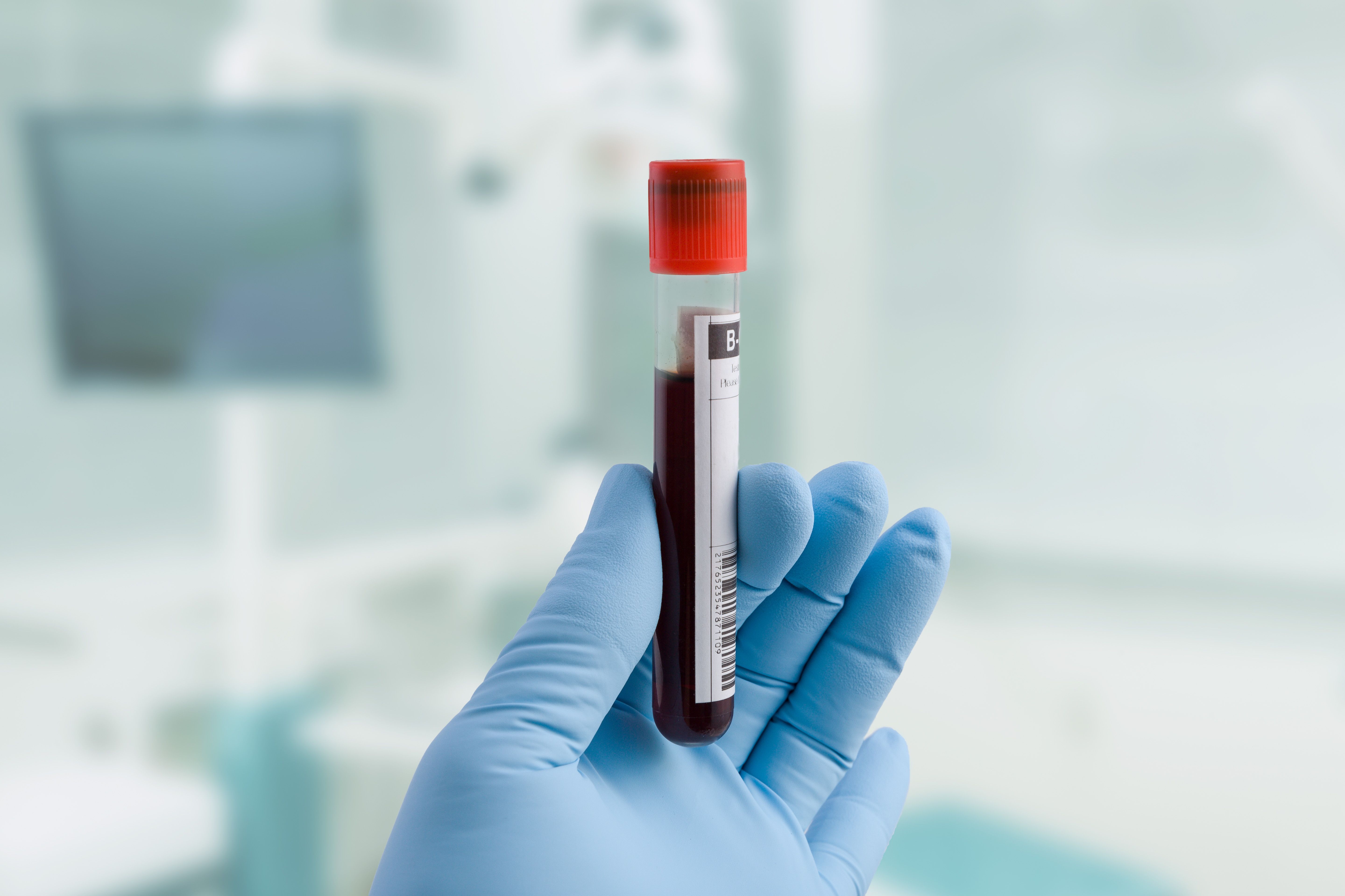 medical samples