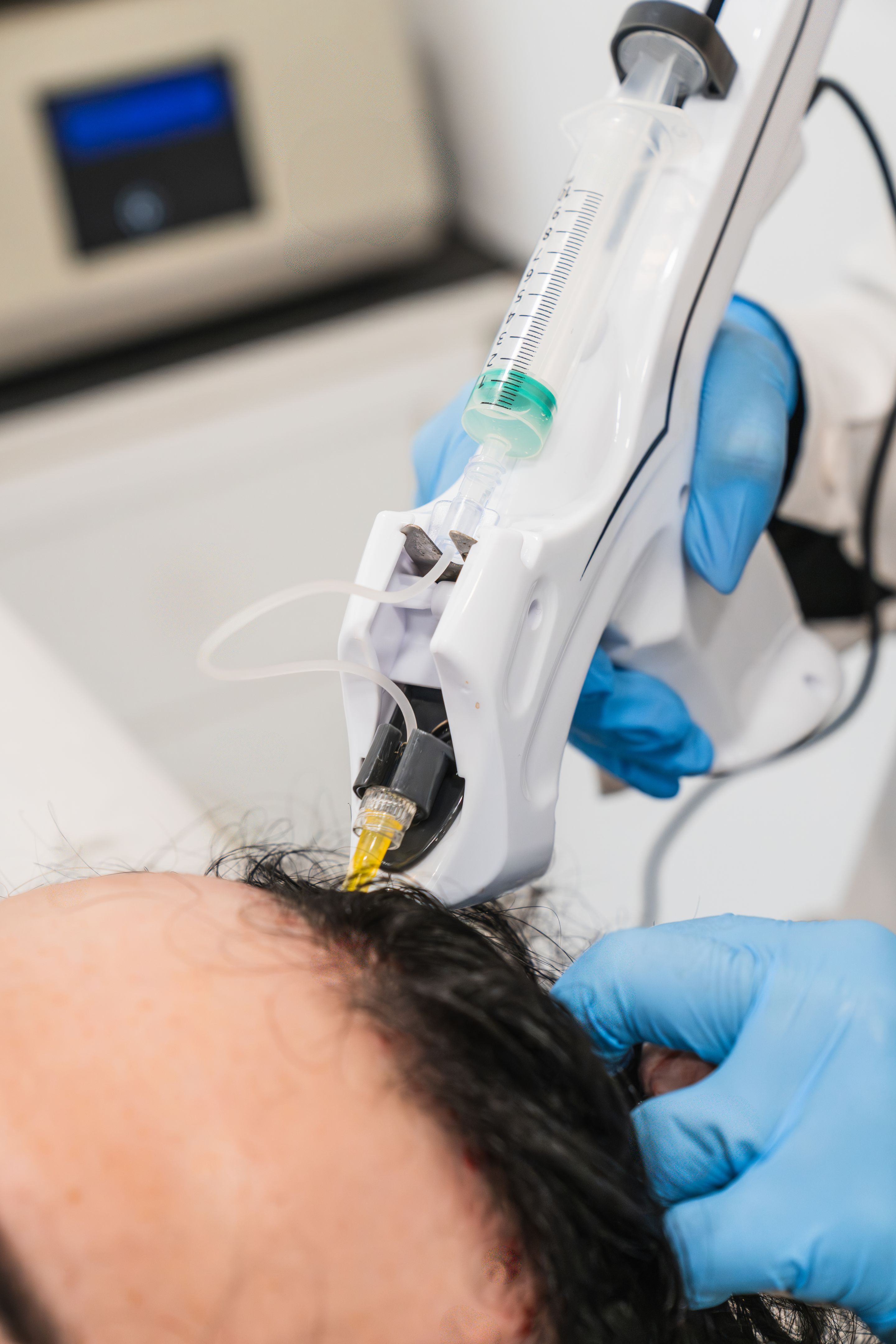 hair transplant clinic