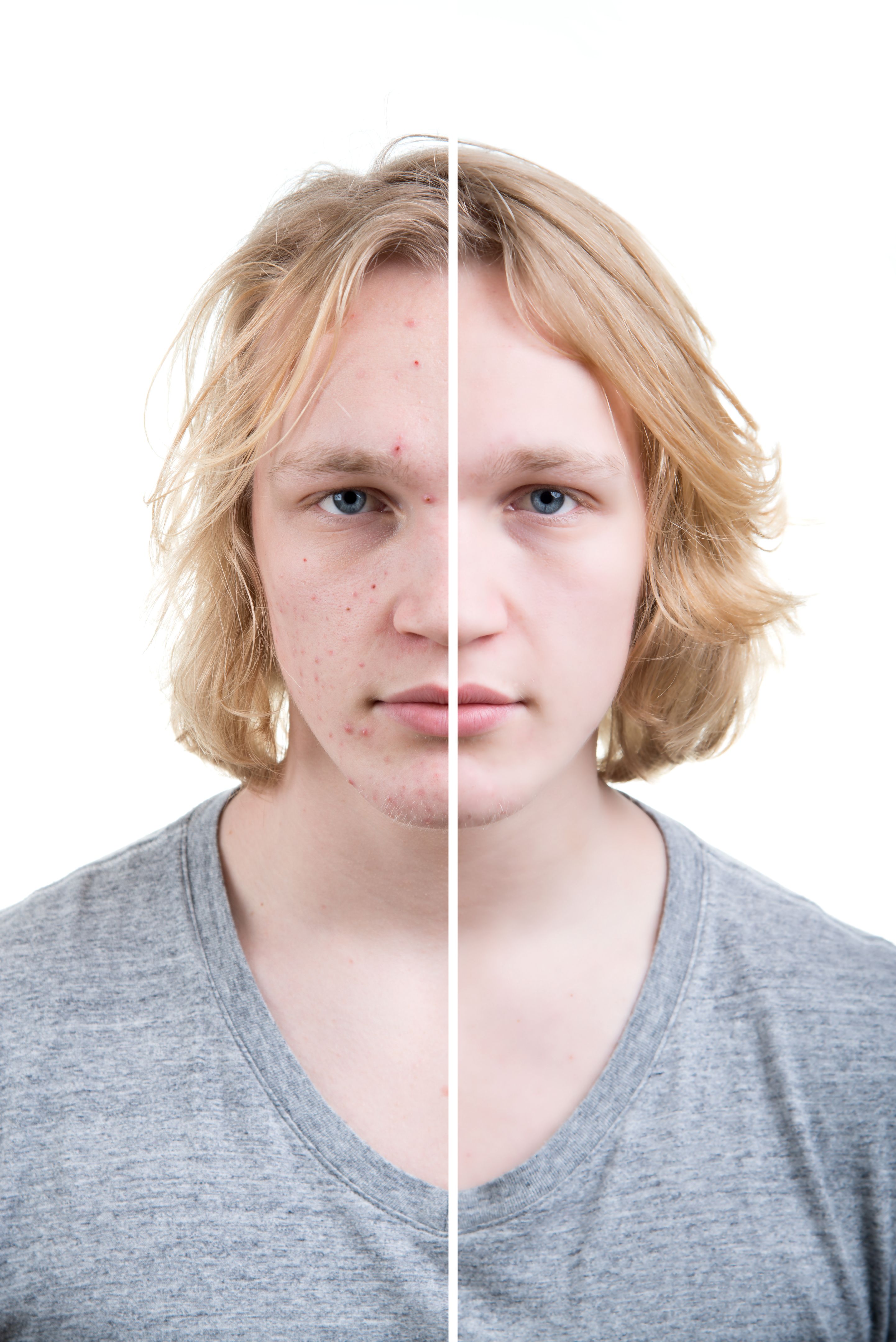 Before and after retouch Before and after retouch