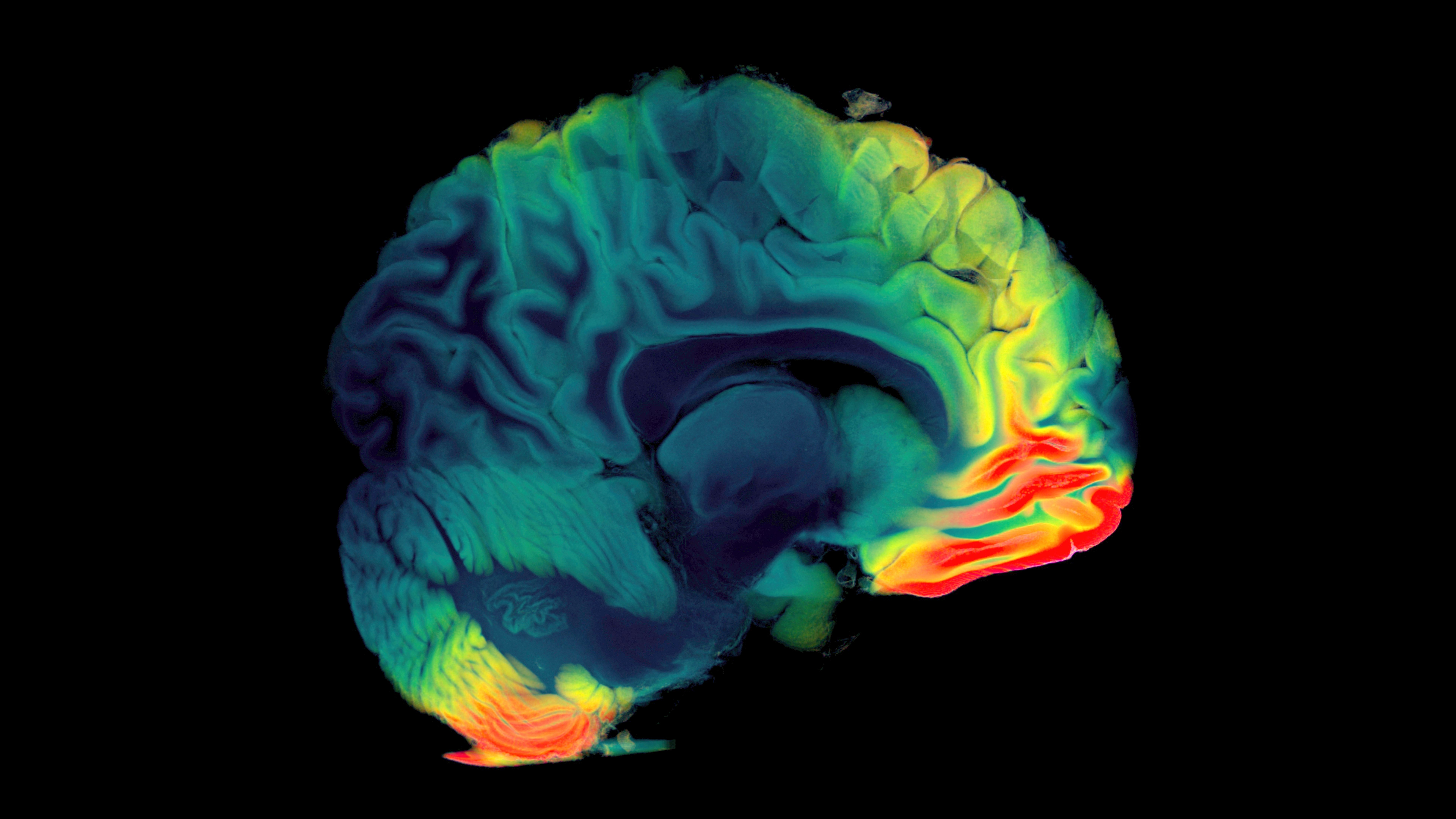 3D visualization of the digital study of the human brain using MTC and MRI 3D visualization of the digital study of the human brain using MTC and MRI