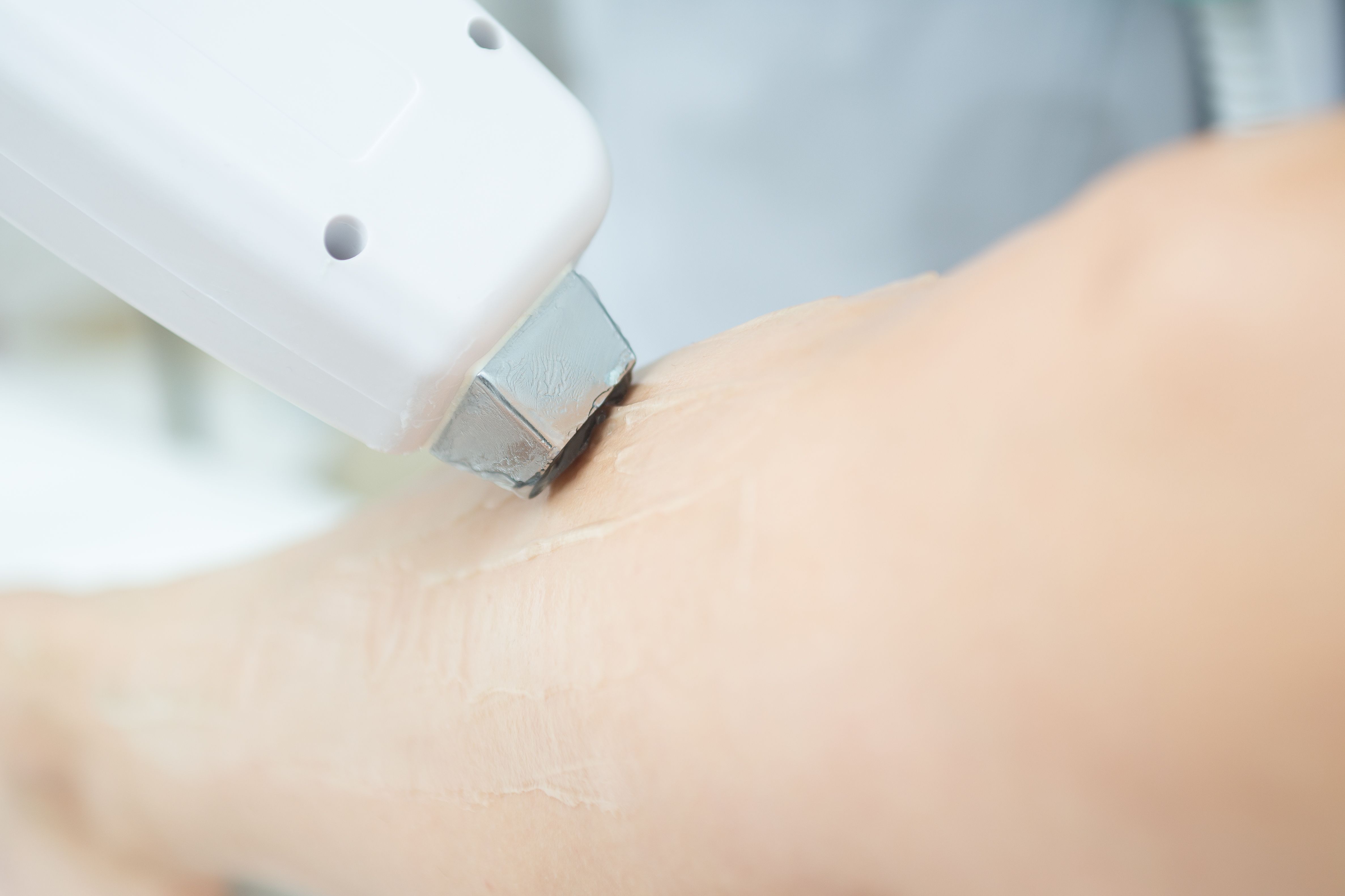 hair removal methods