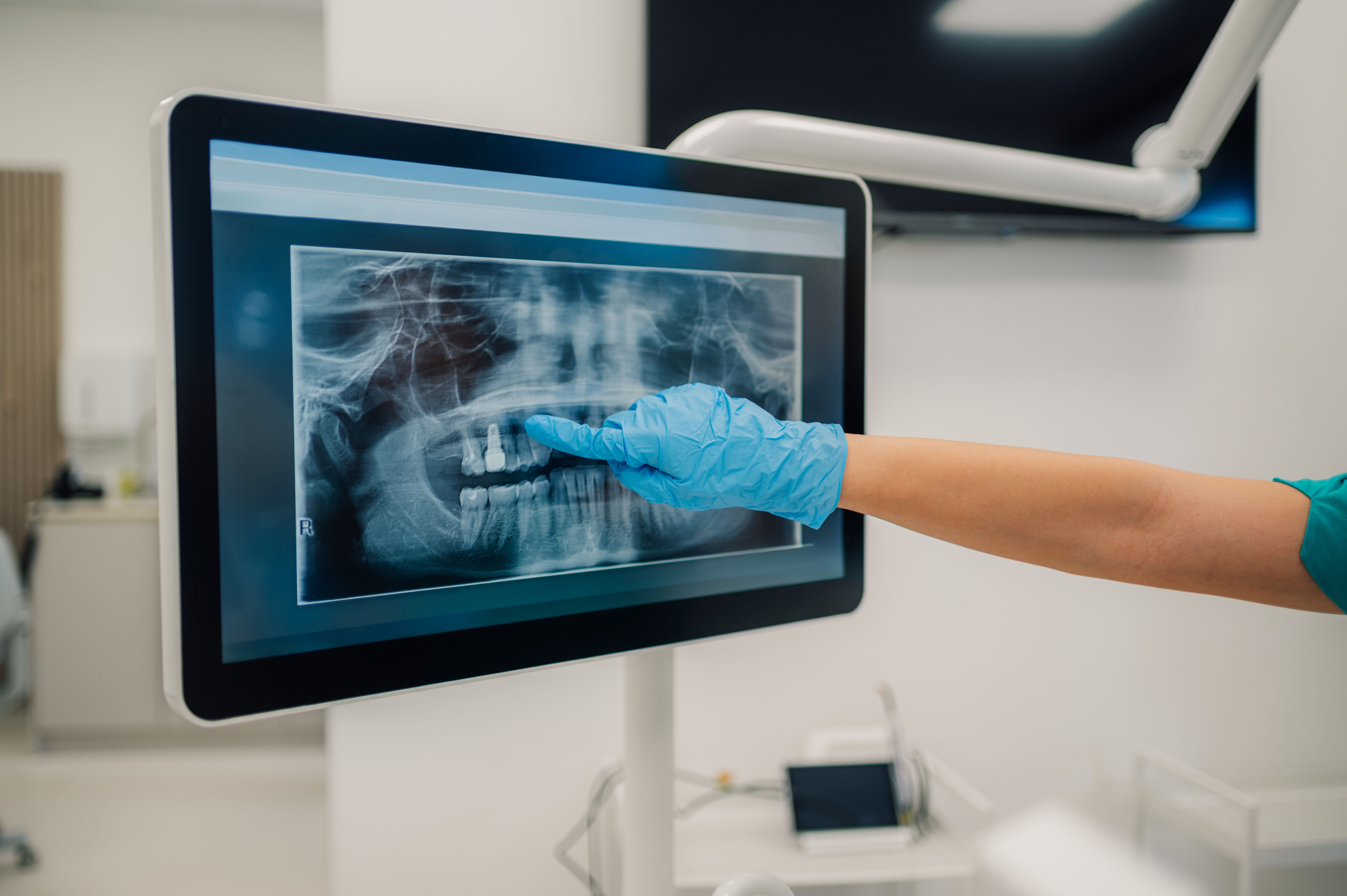 digital dental imaging