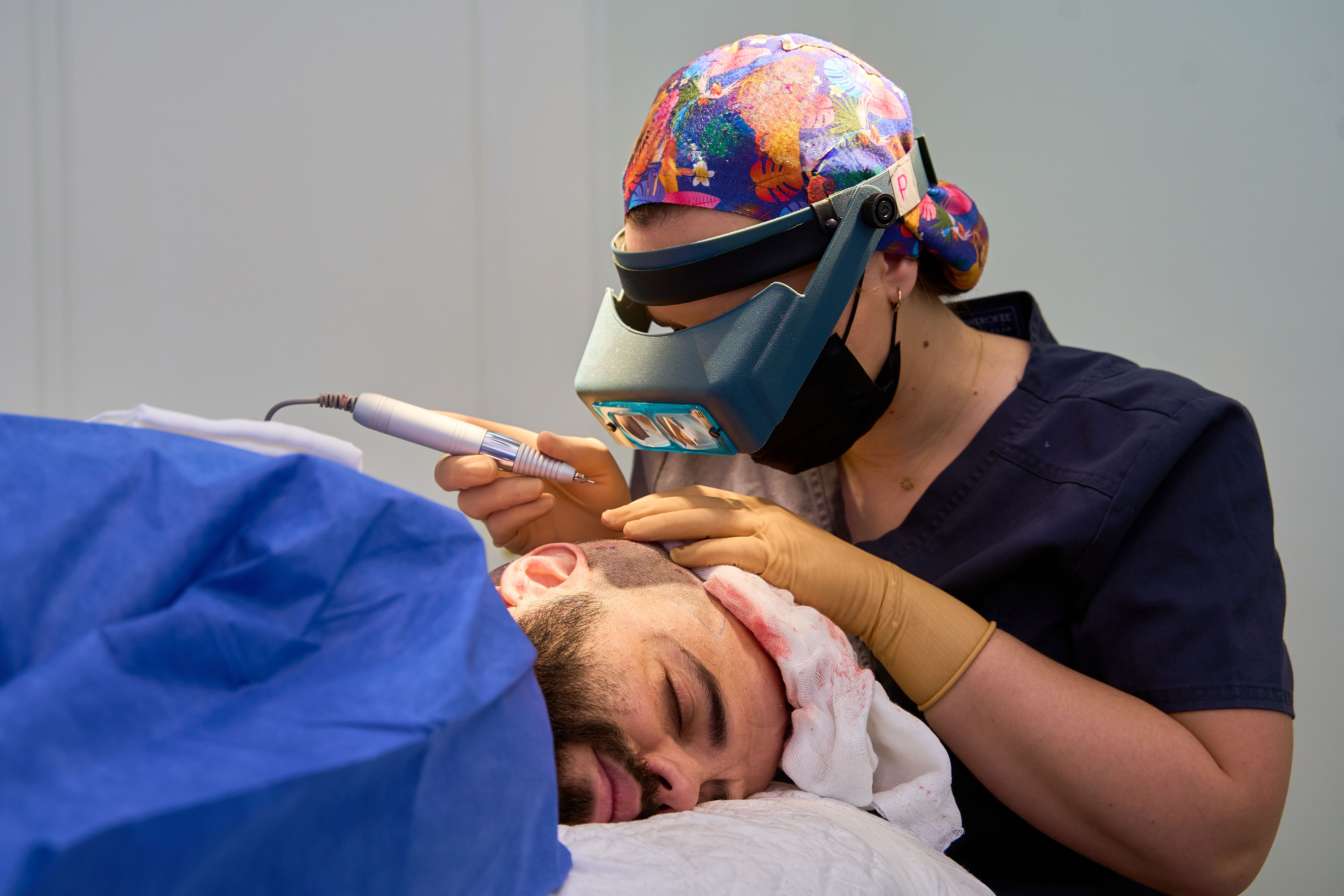 hair transplant precision