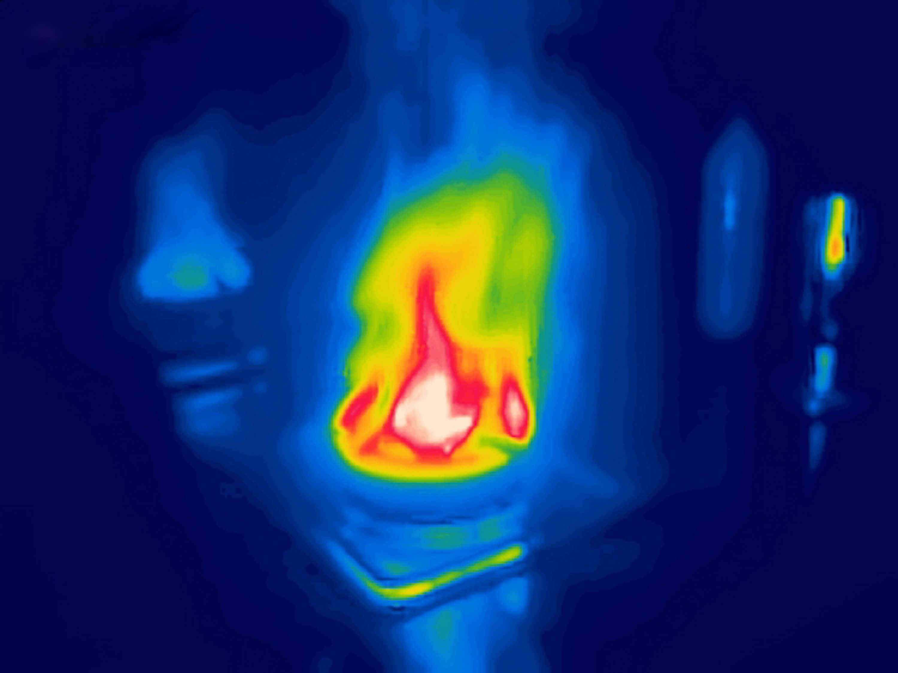 thermal imaging