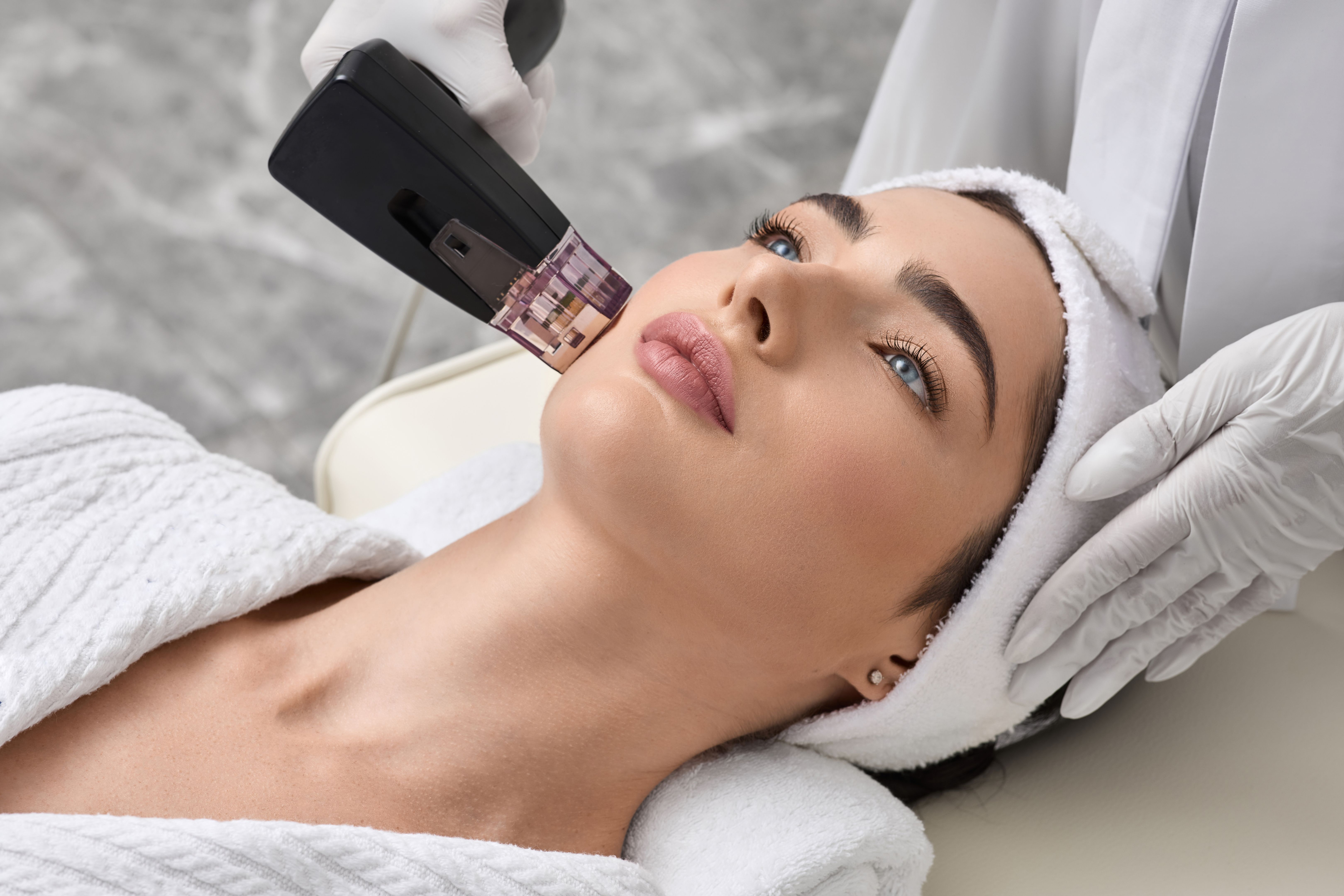 microneedling treatment