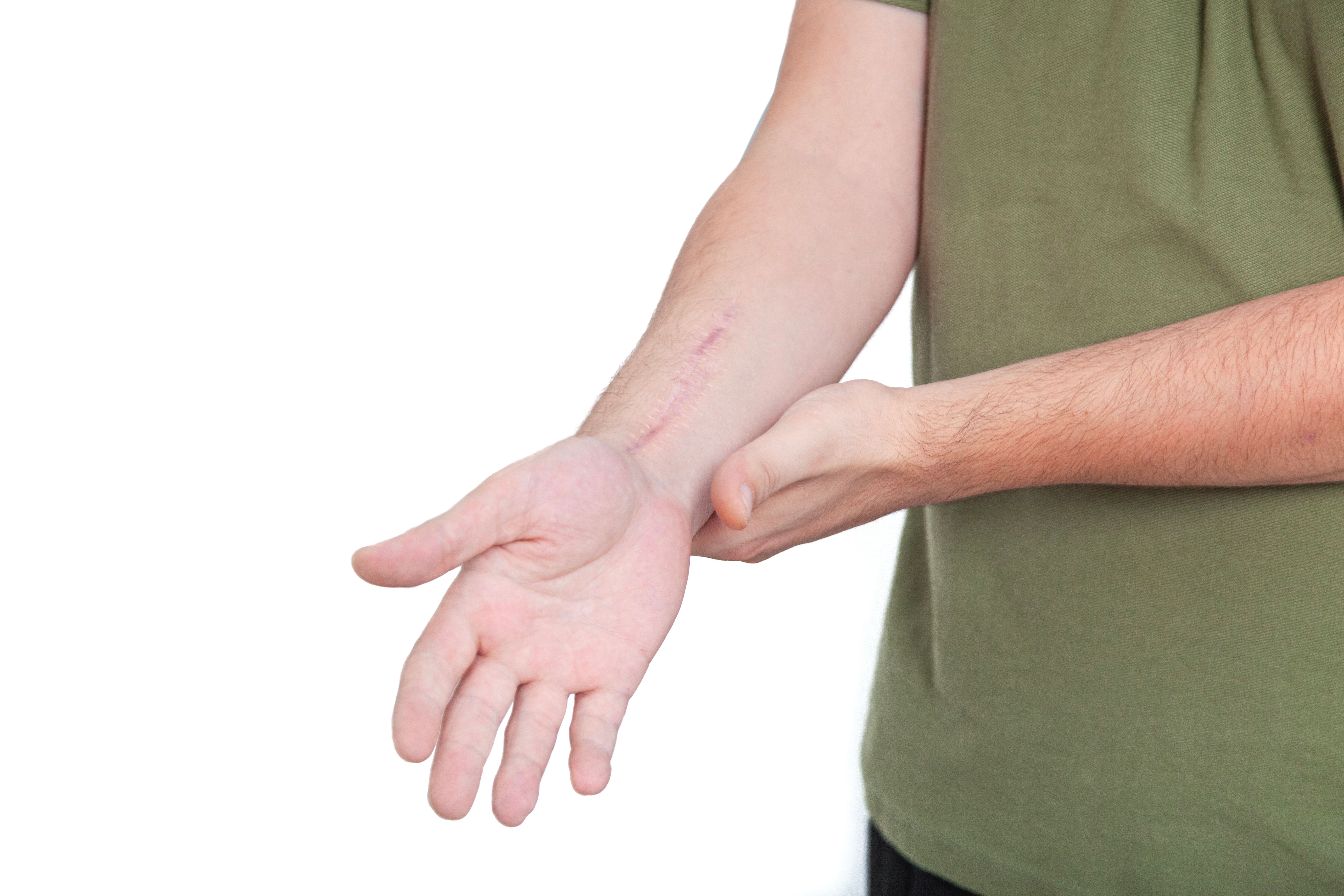 tissue repair