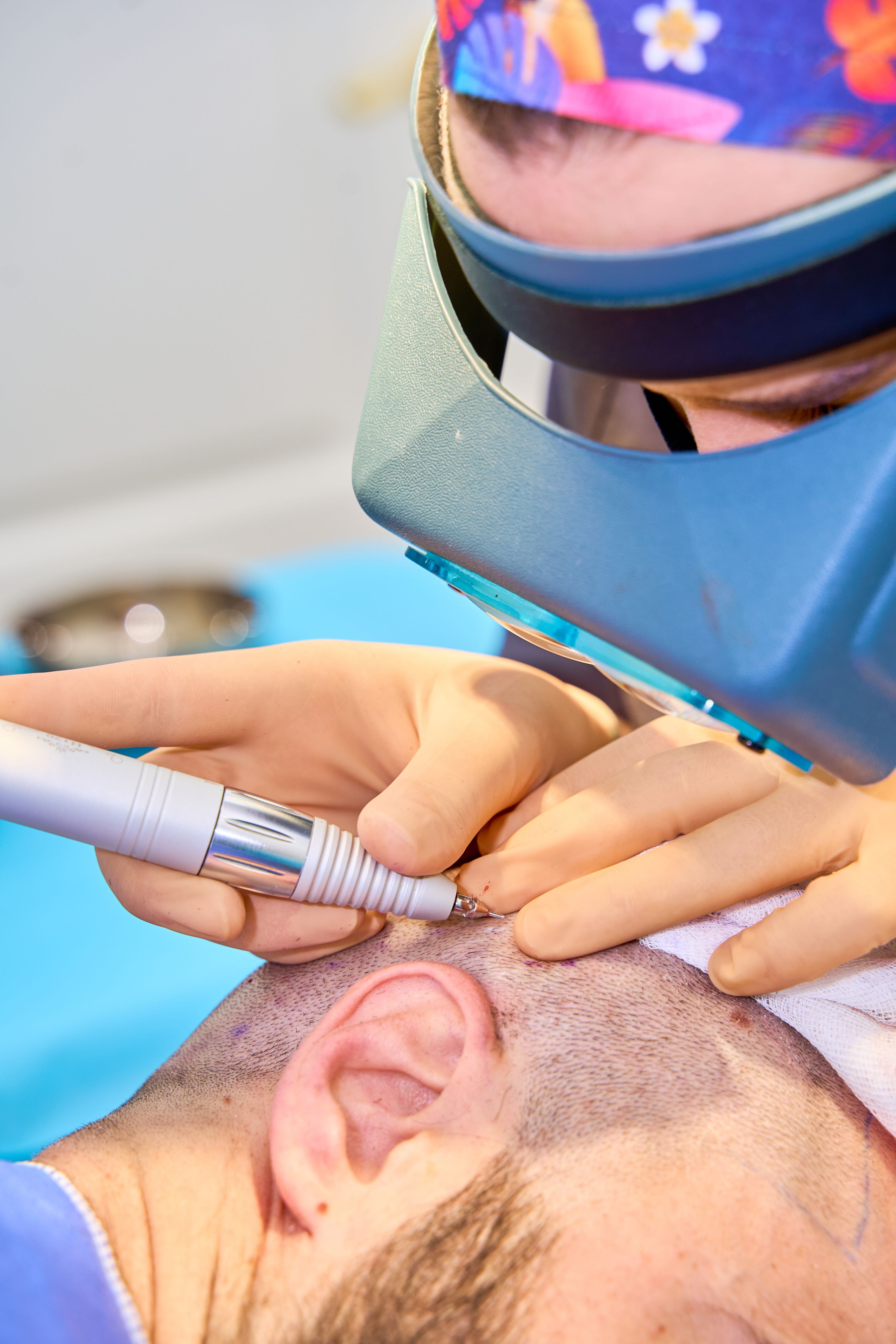 hair transplant surgery