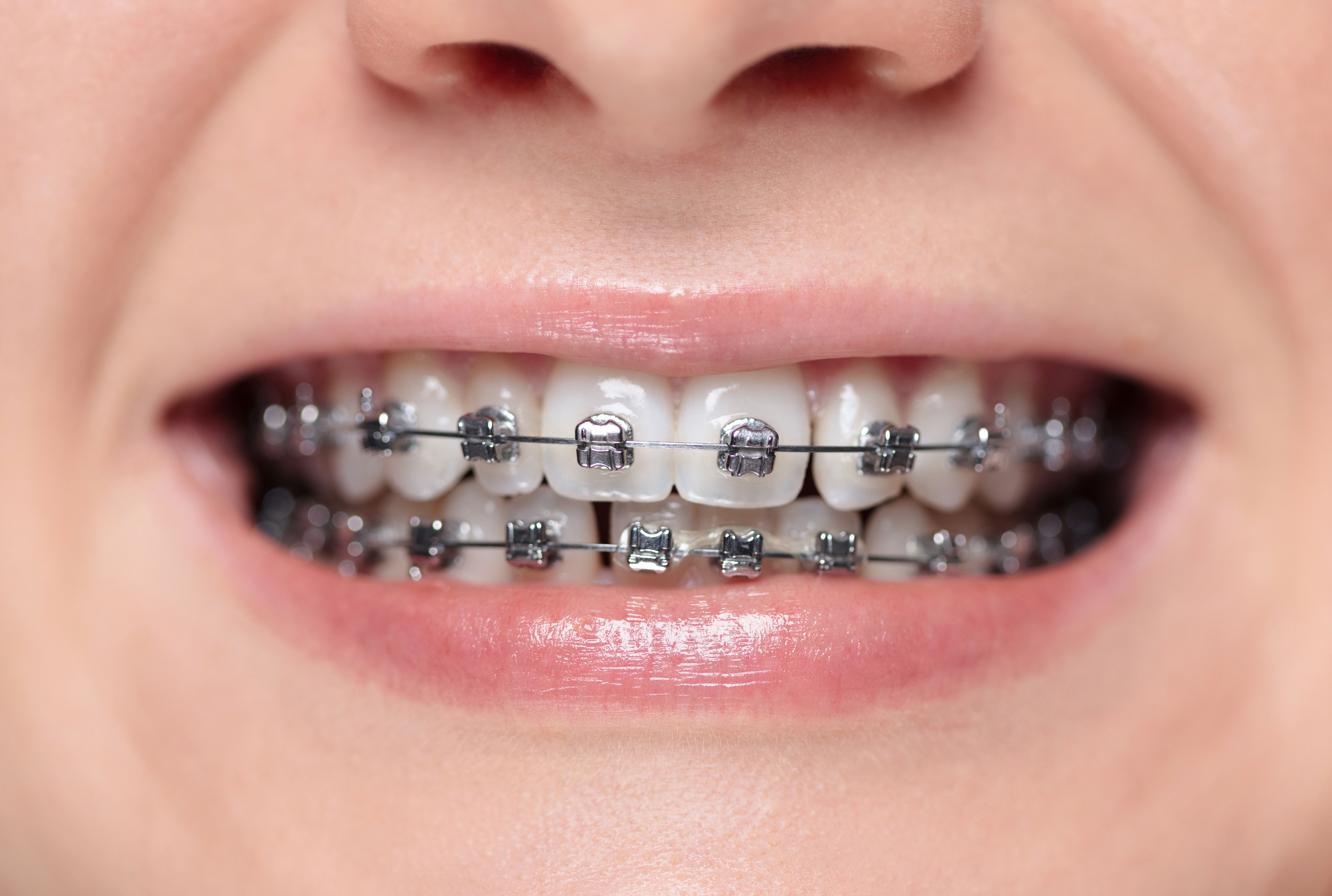 orthodontic care