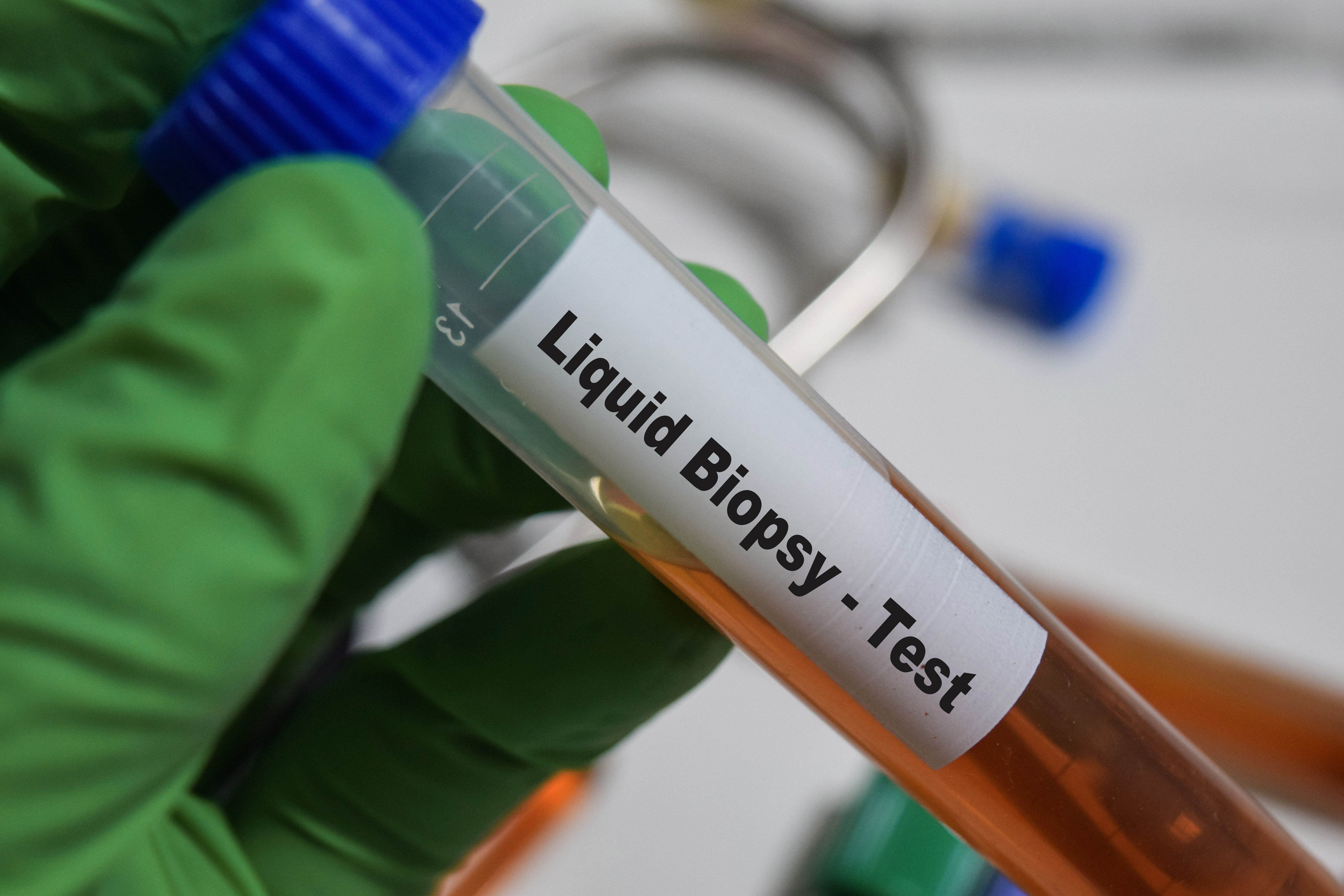liquid biopsy research