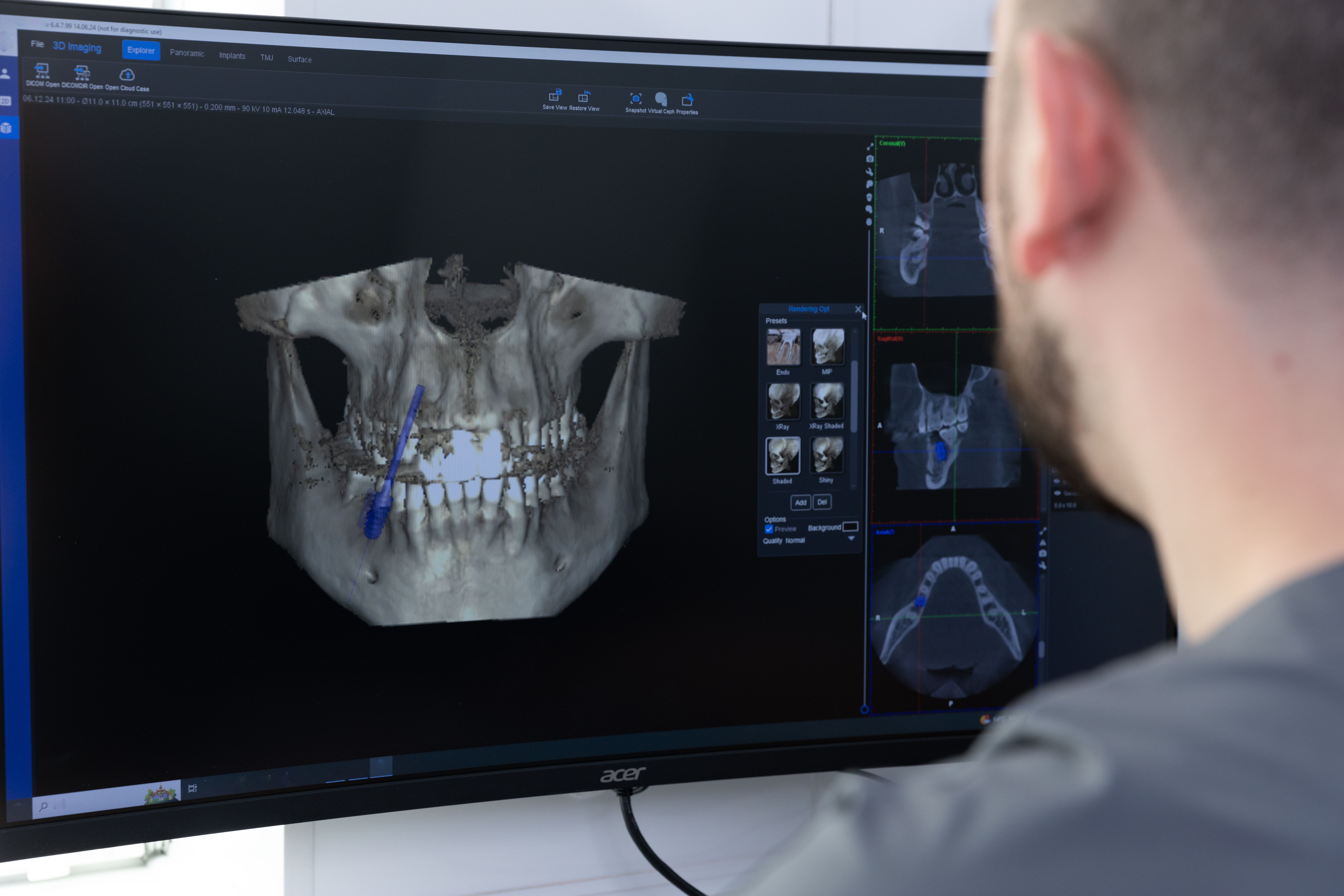 3d imaging