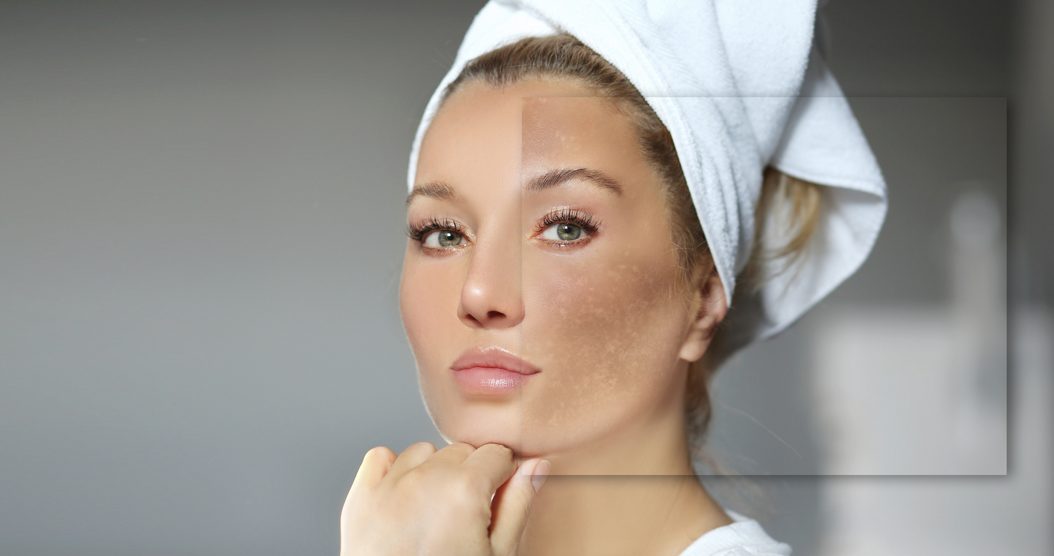 Dark spots, freckles,hyperpigmentation(melasma or chloasma),concept - skin lightening, skin whitening, fruit acids,AHA, Skin Brightening Dark spots, freckles,hyperpigmentation(melasma or chloasma),concept - skin lightening, skin whitening, fruit acids,AHA, Skin Brightening