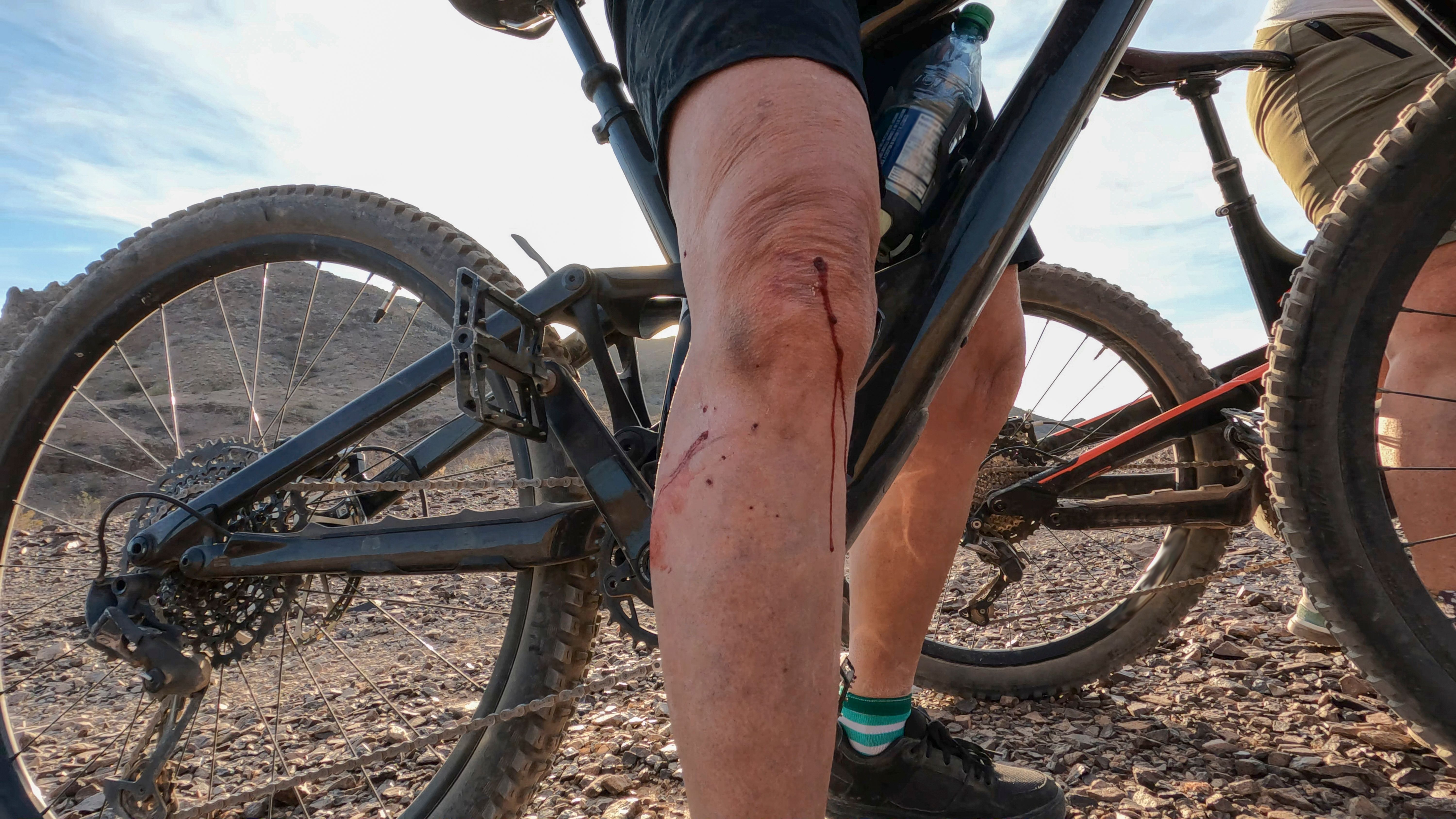arizona personal injury