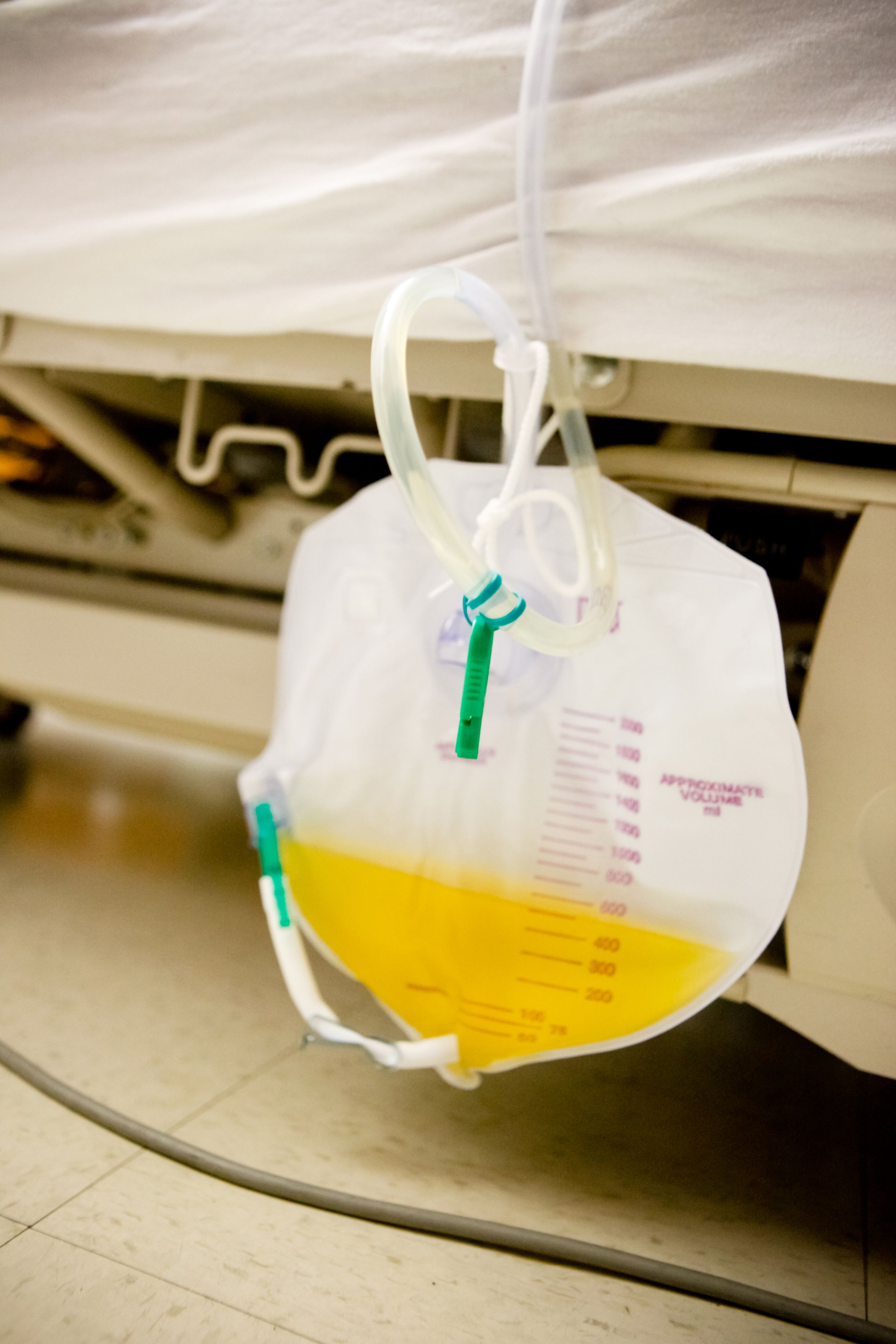 Medical Grade Urine Collection Bag