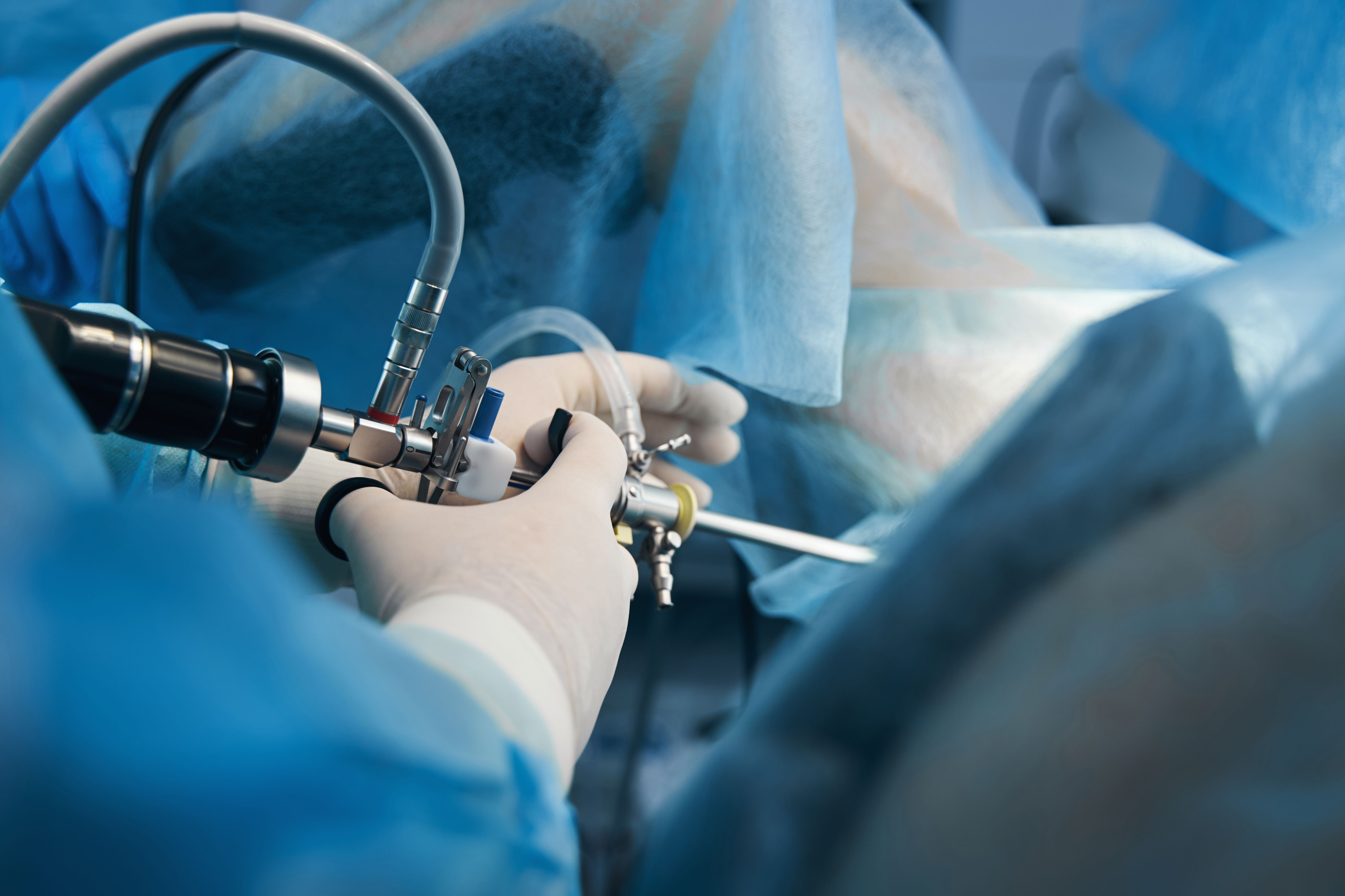 arthroscopy surgery