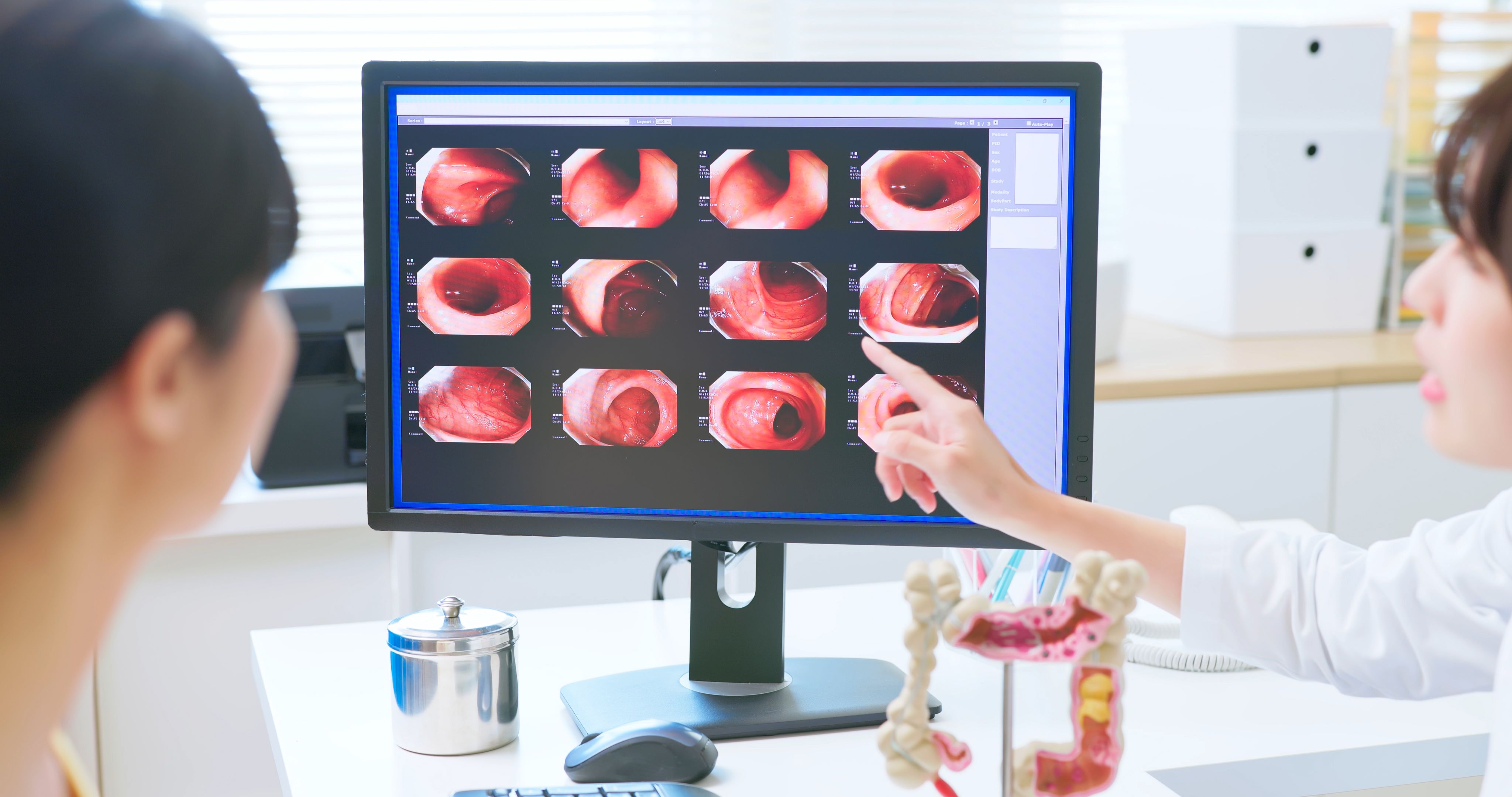 medical consultation after colonoscopy