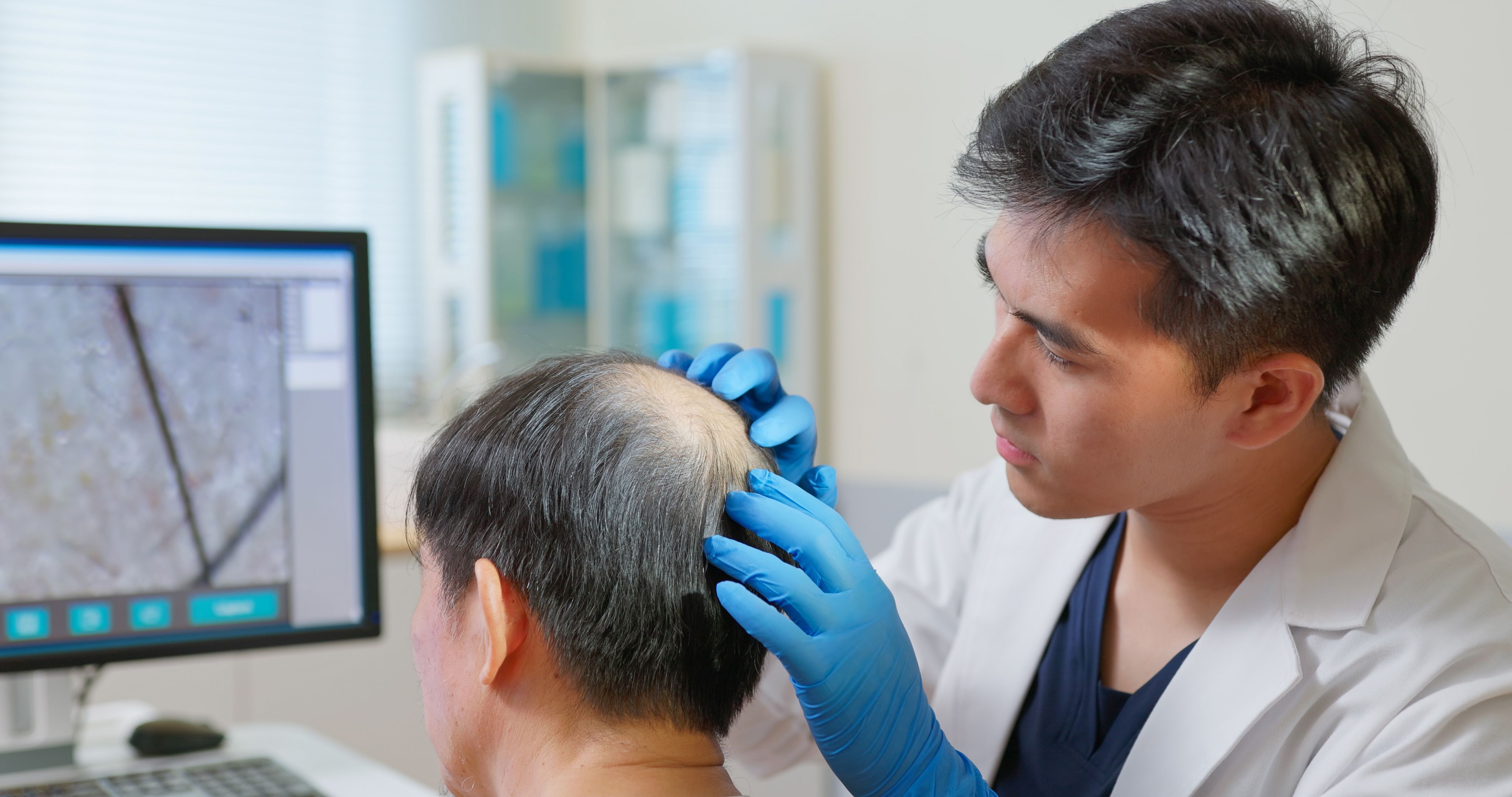 hair transplant care