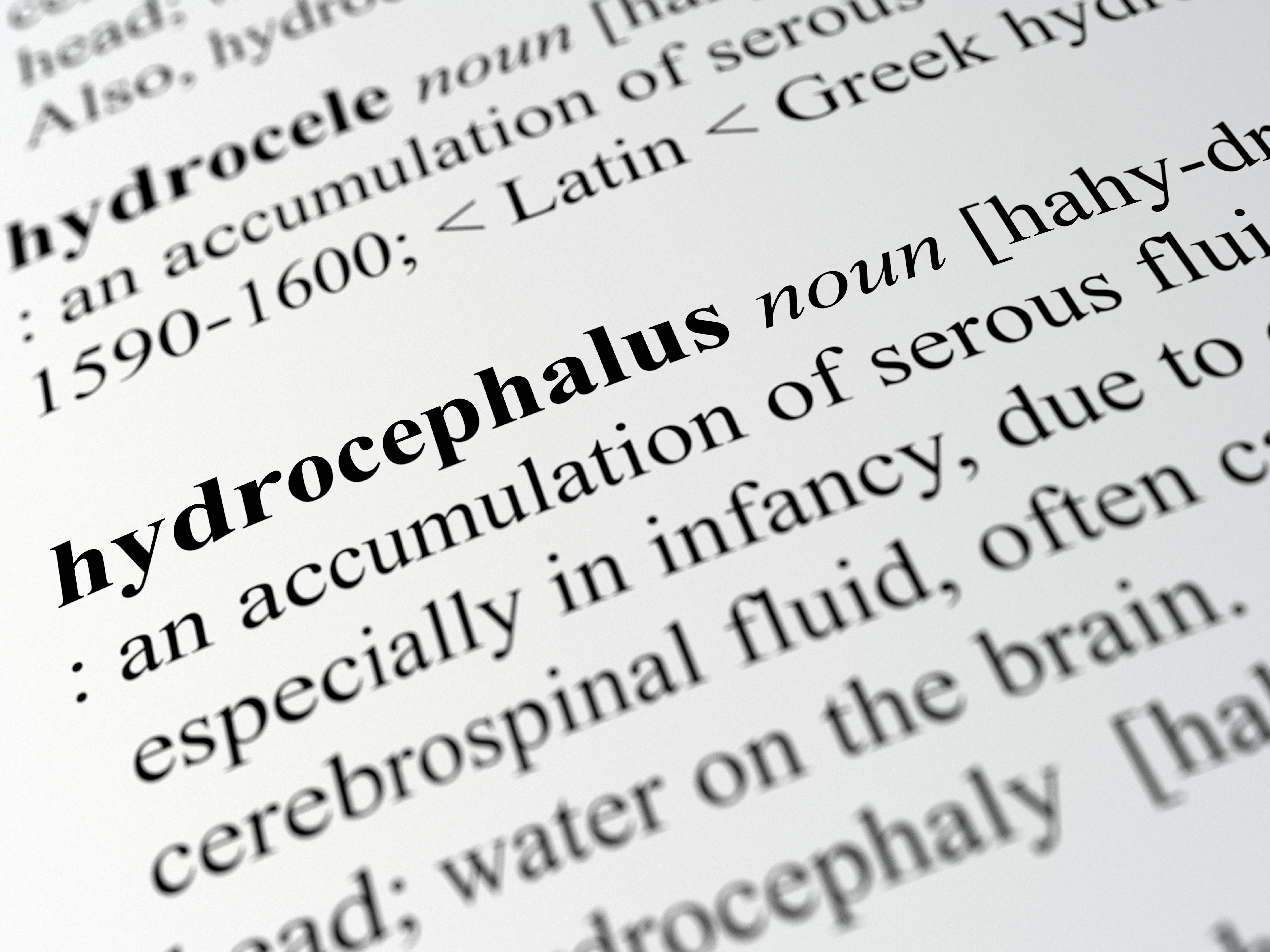 hydrocephalus hydrocephalus
