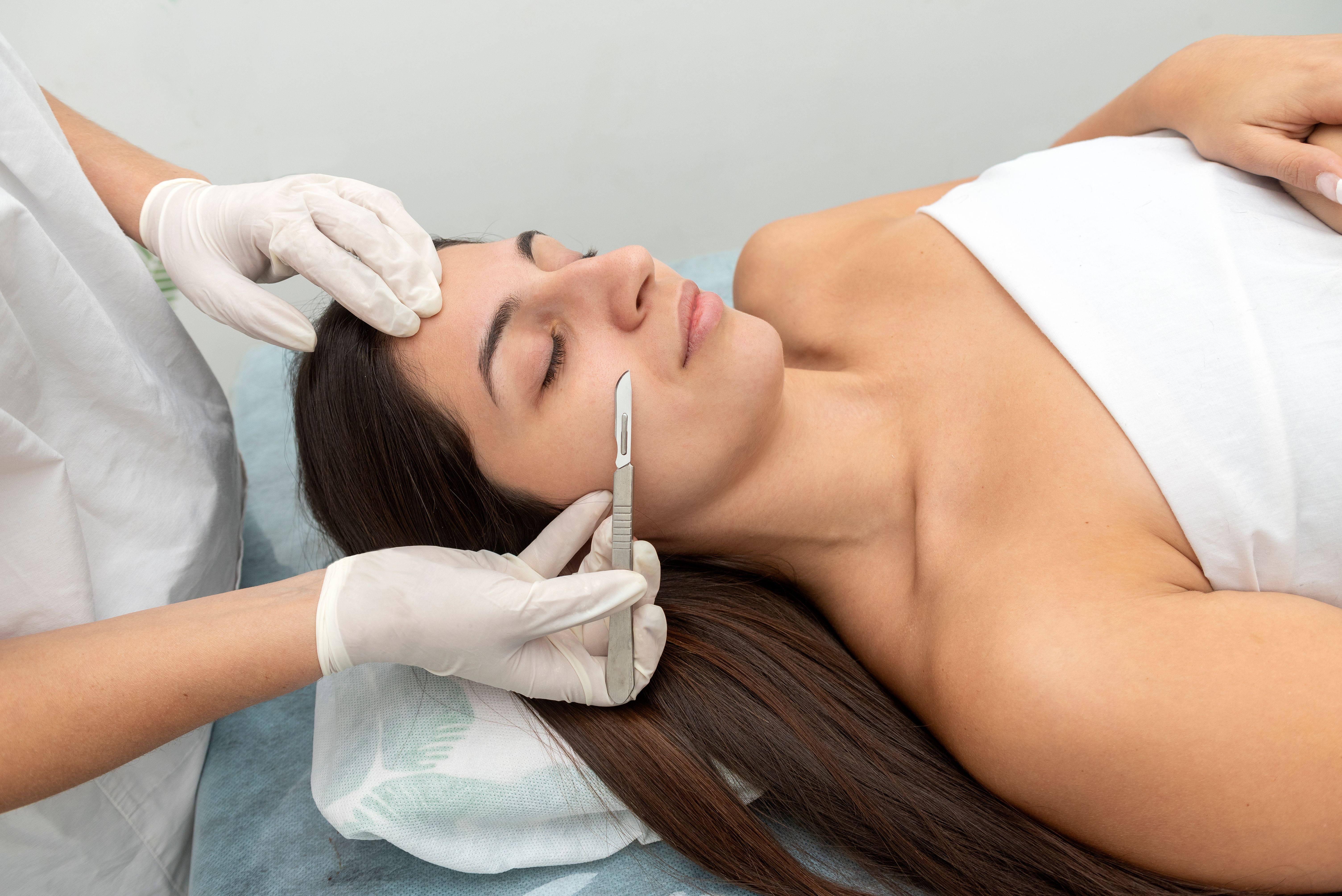dermaplaning treatment