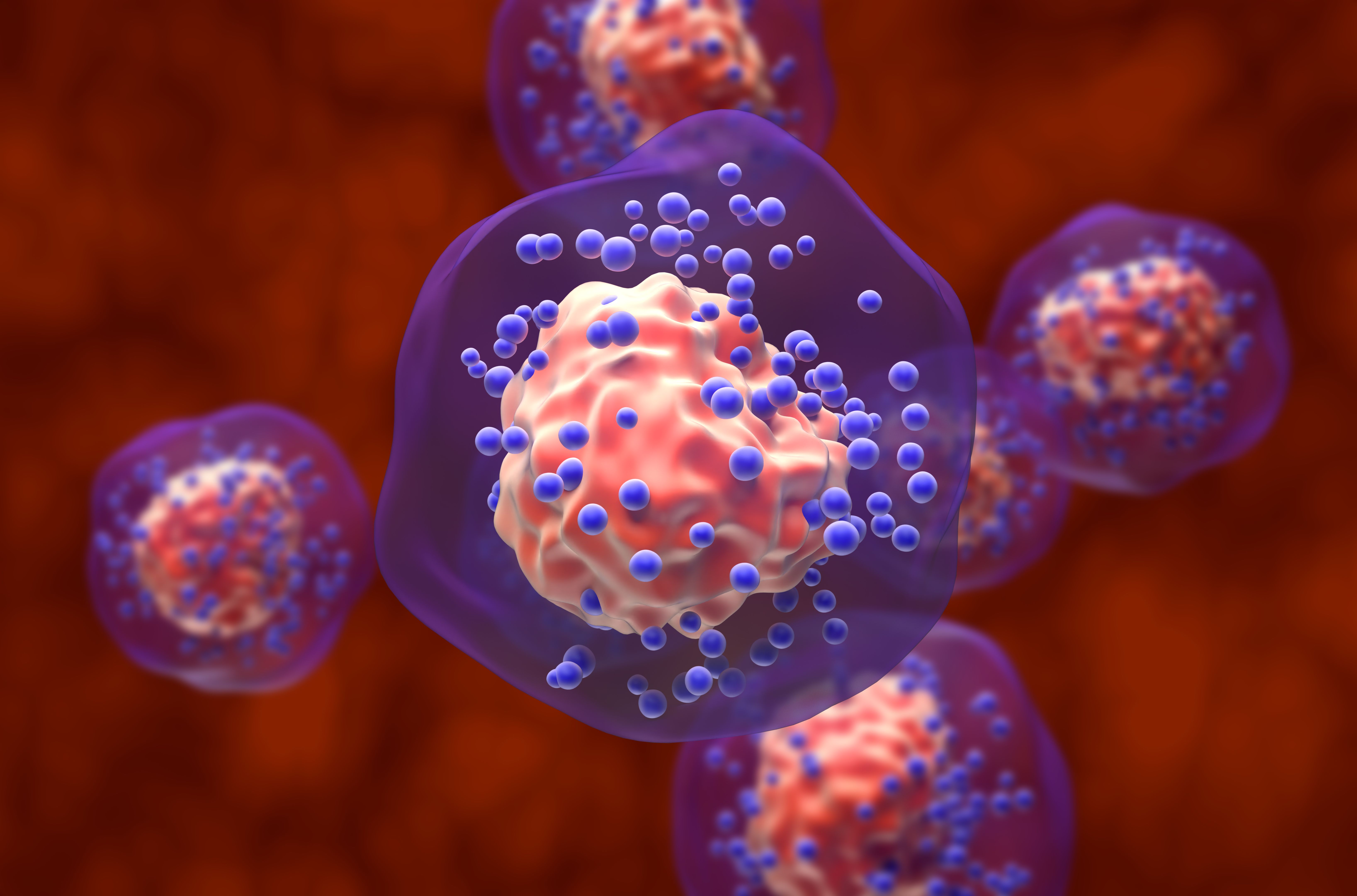 breast cancer technology