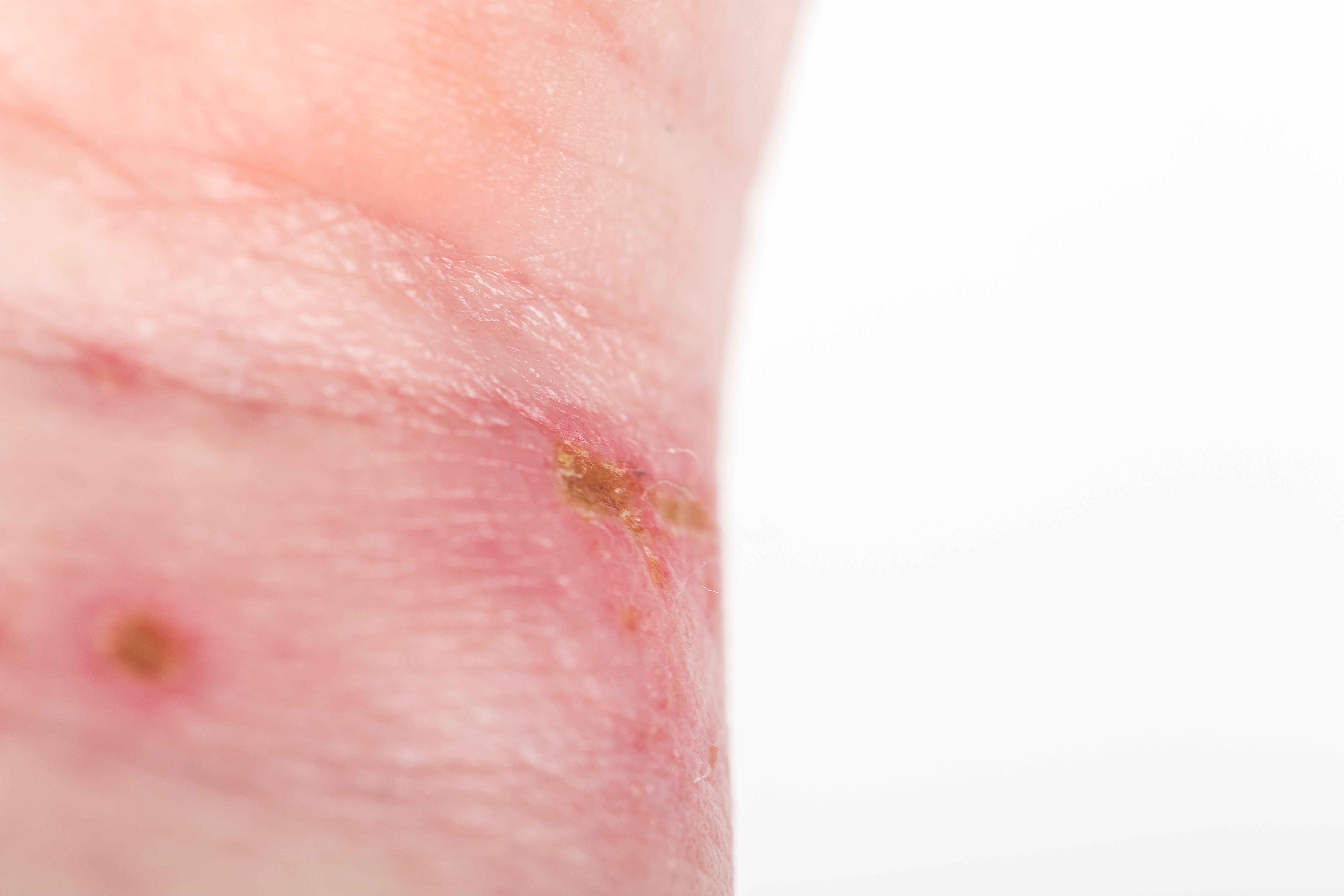 professional striping