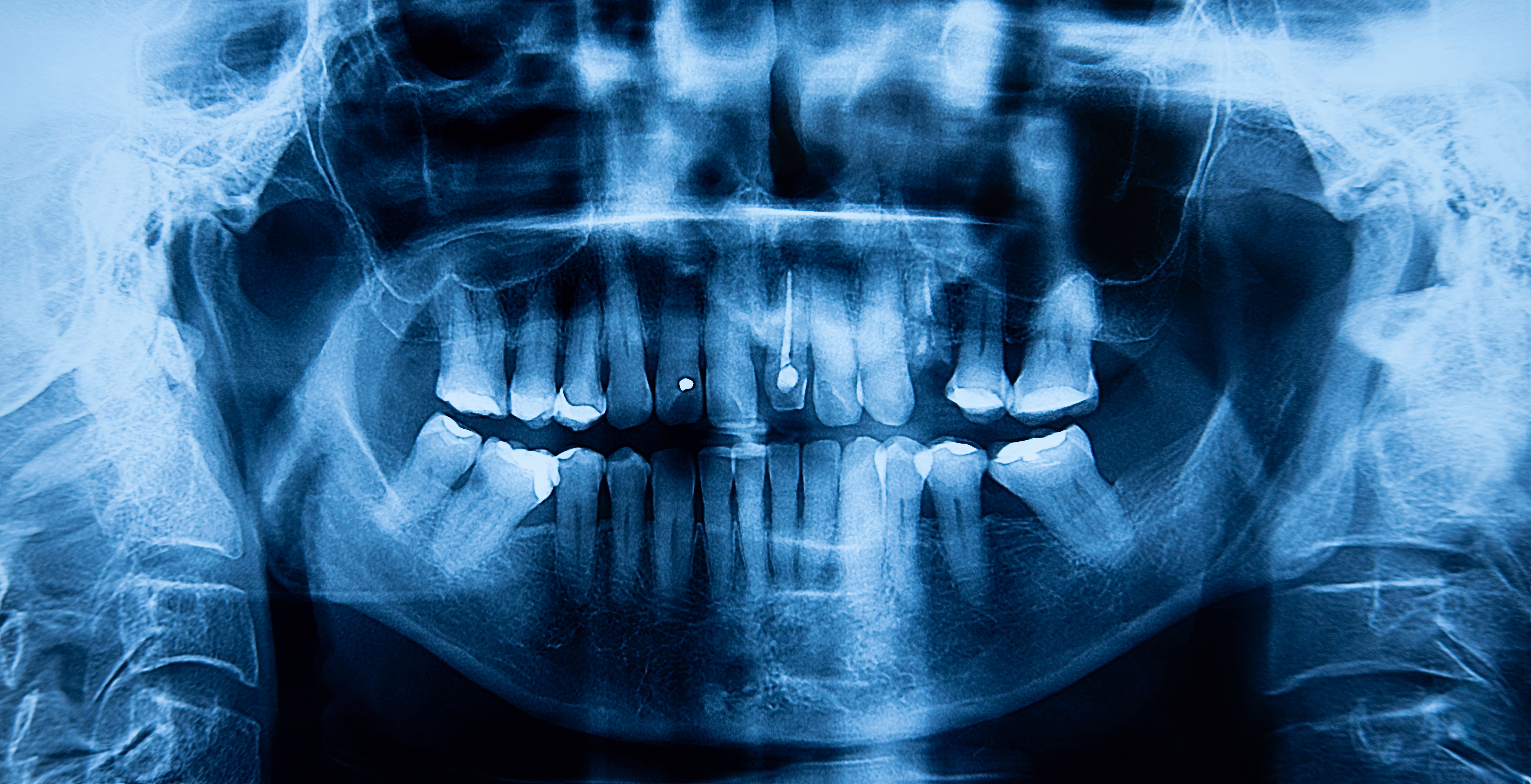 x-ray technology