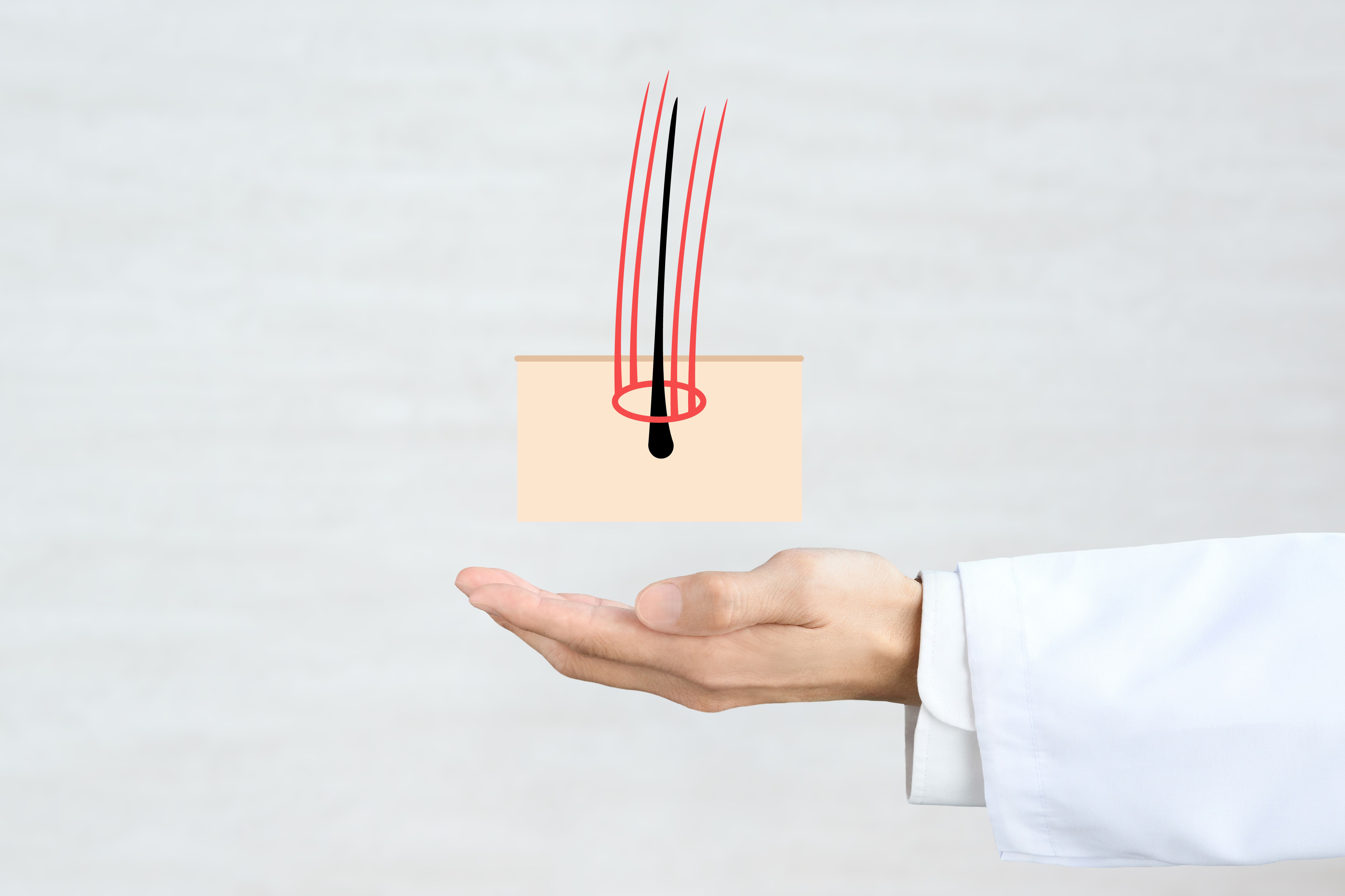 hair transplant consultation