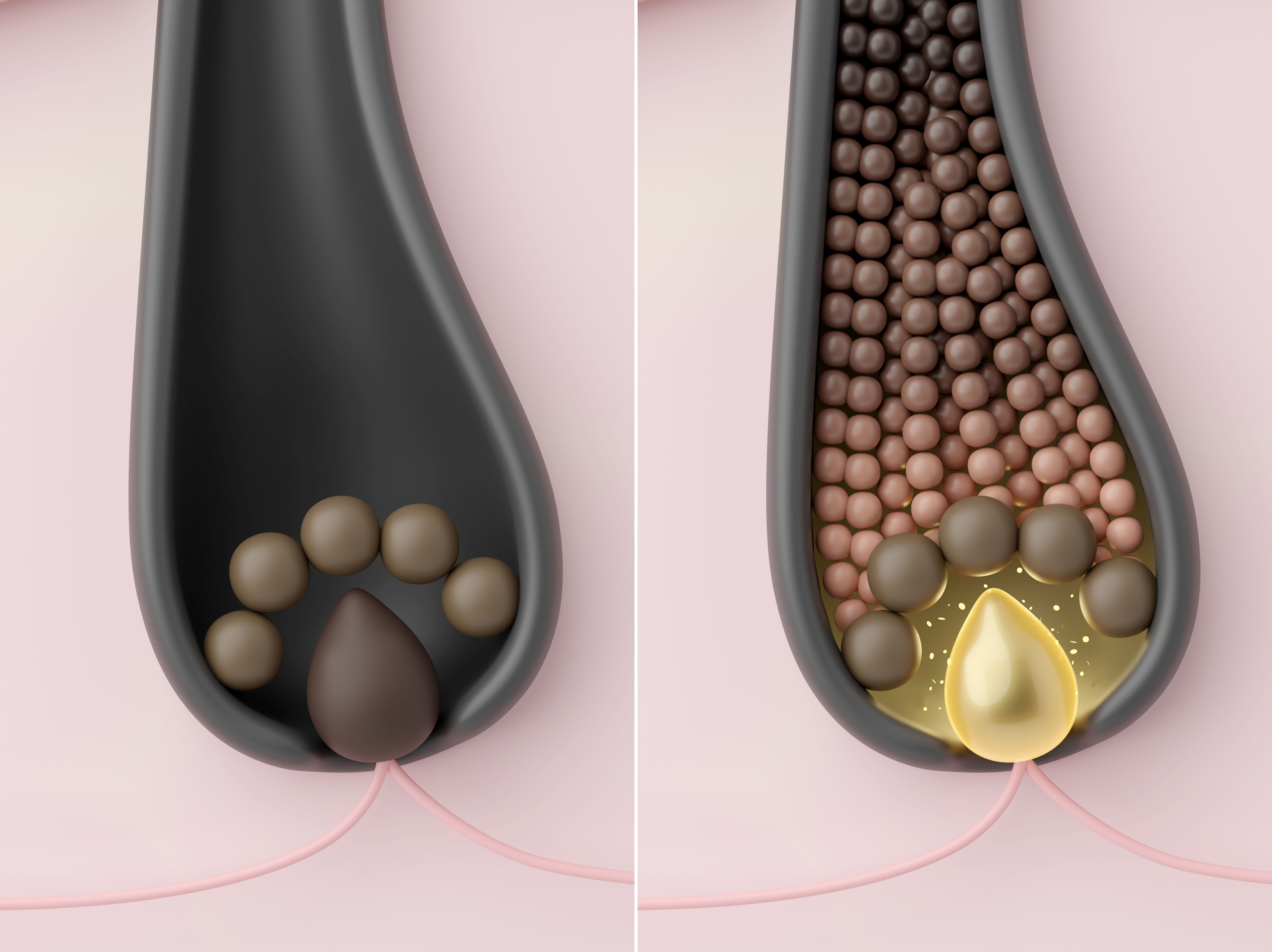 before and after hair