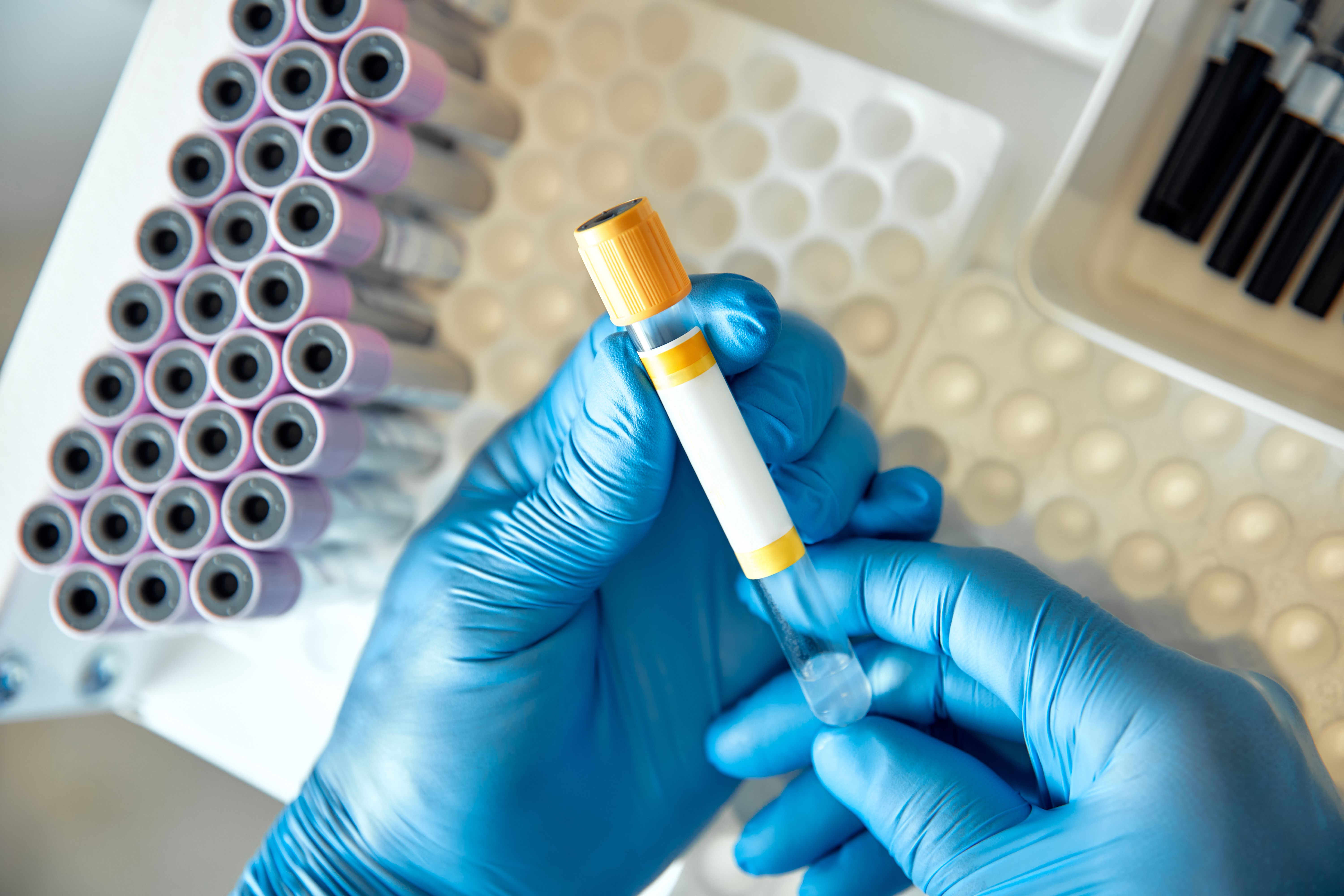 medical samples handling
