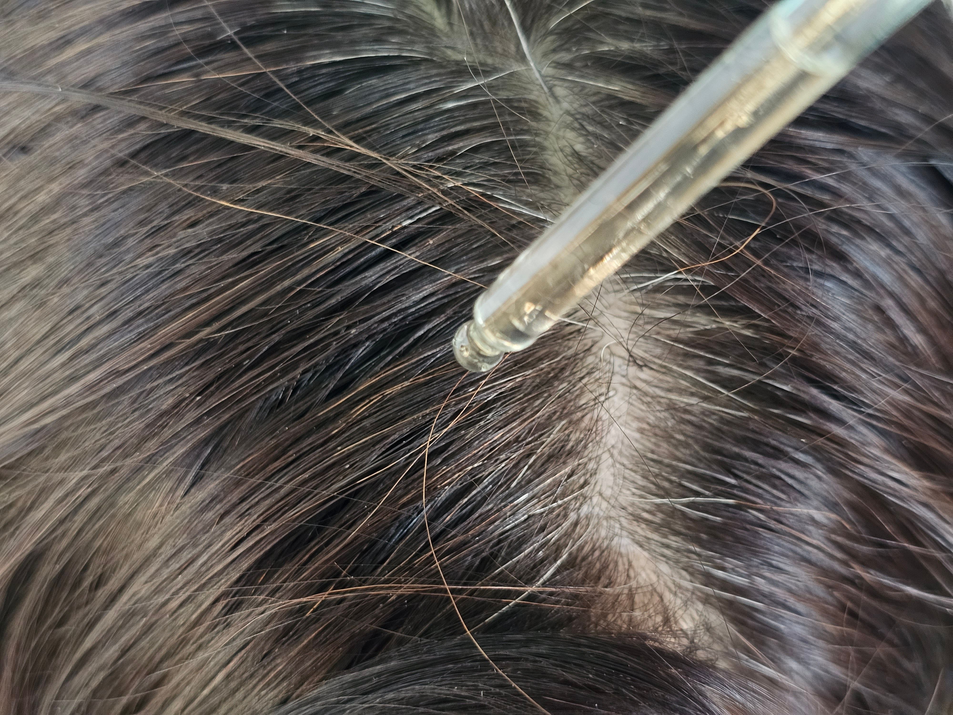 organic scalp treatment