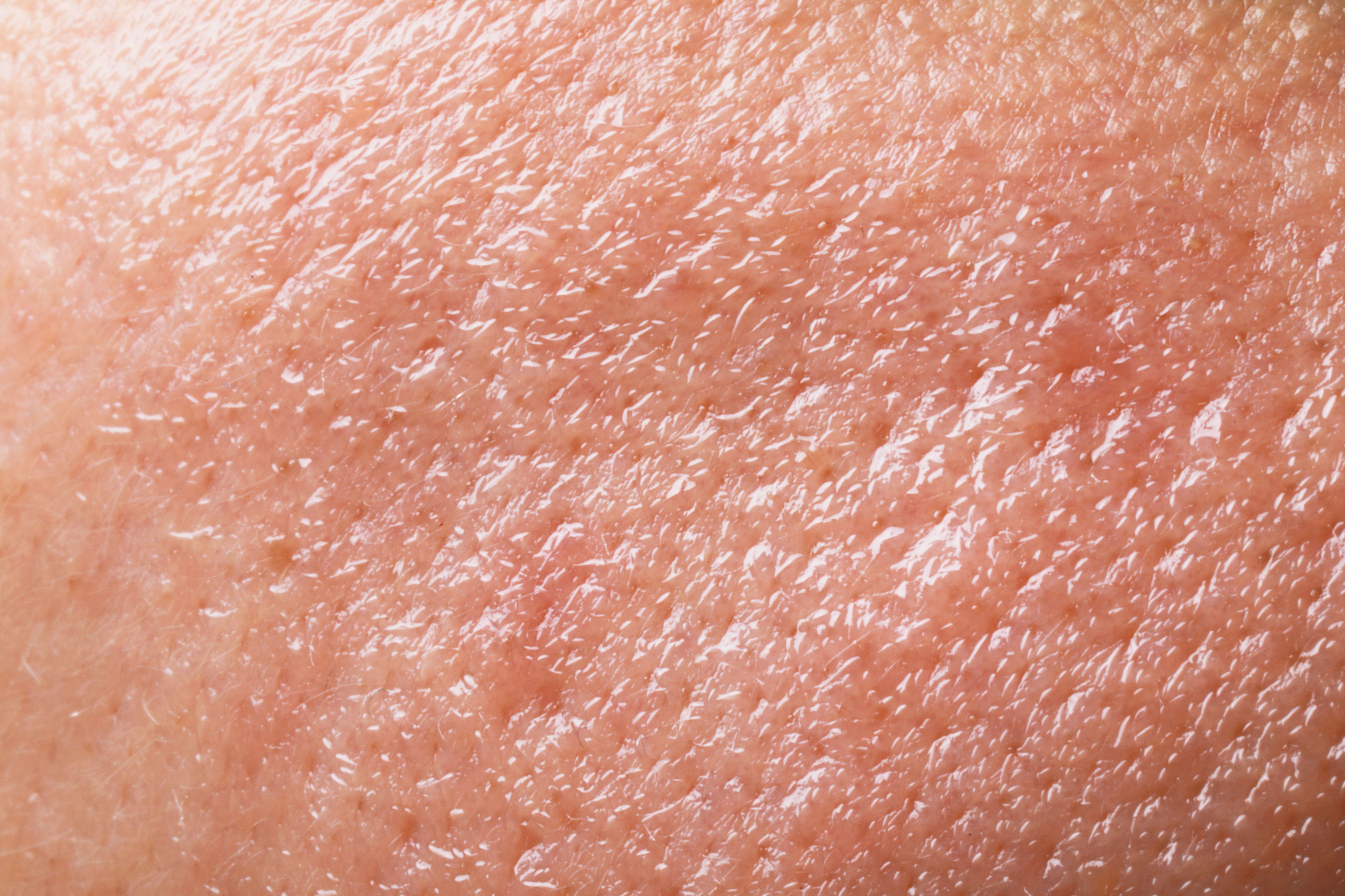 oily skin moisturizer