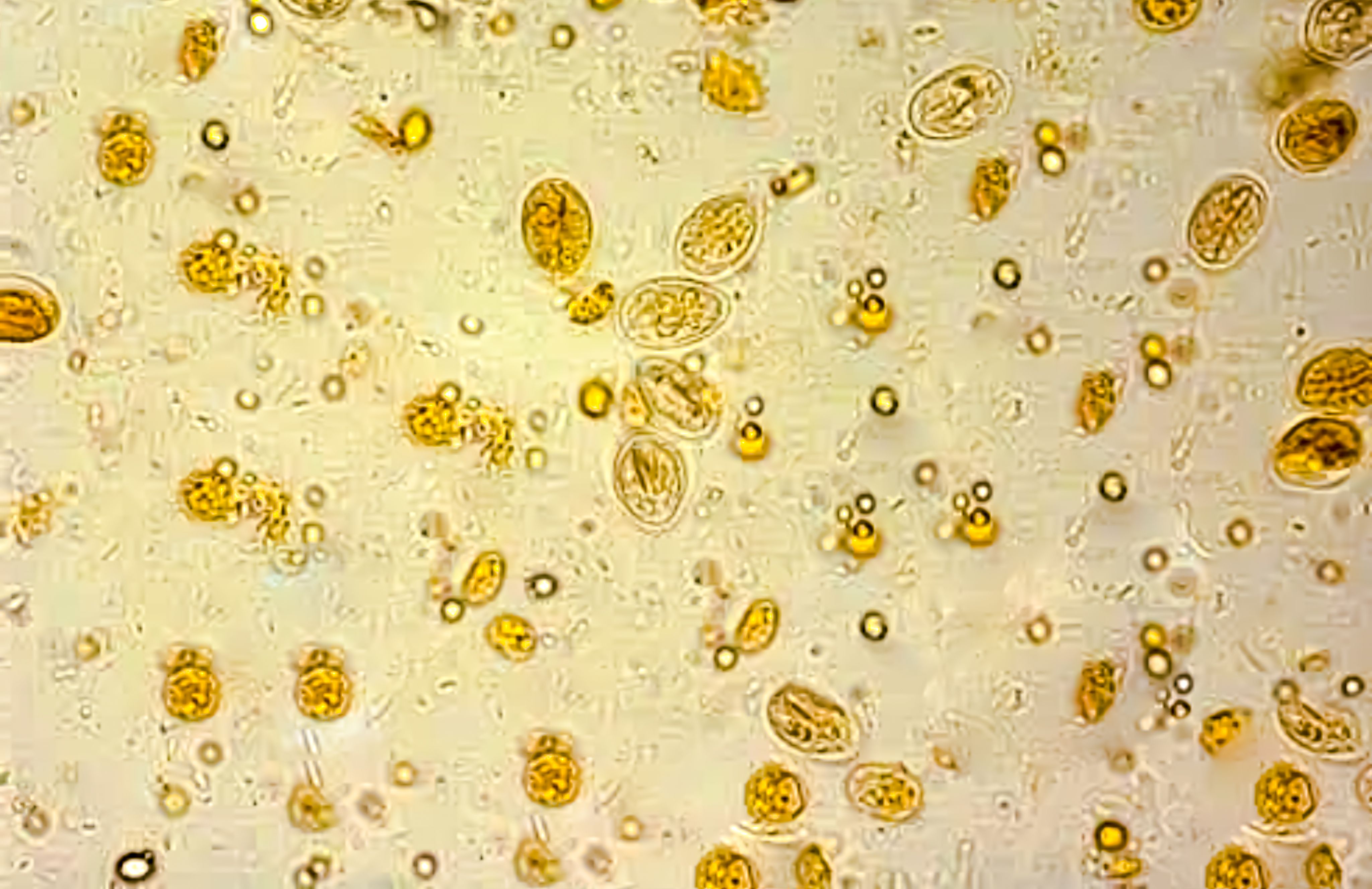 Giardia lamblia cyst analysed by microscope. causing diarrhea