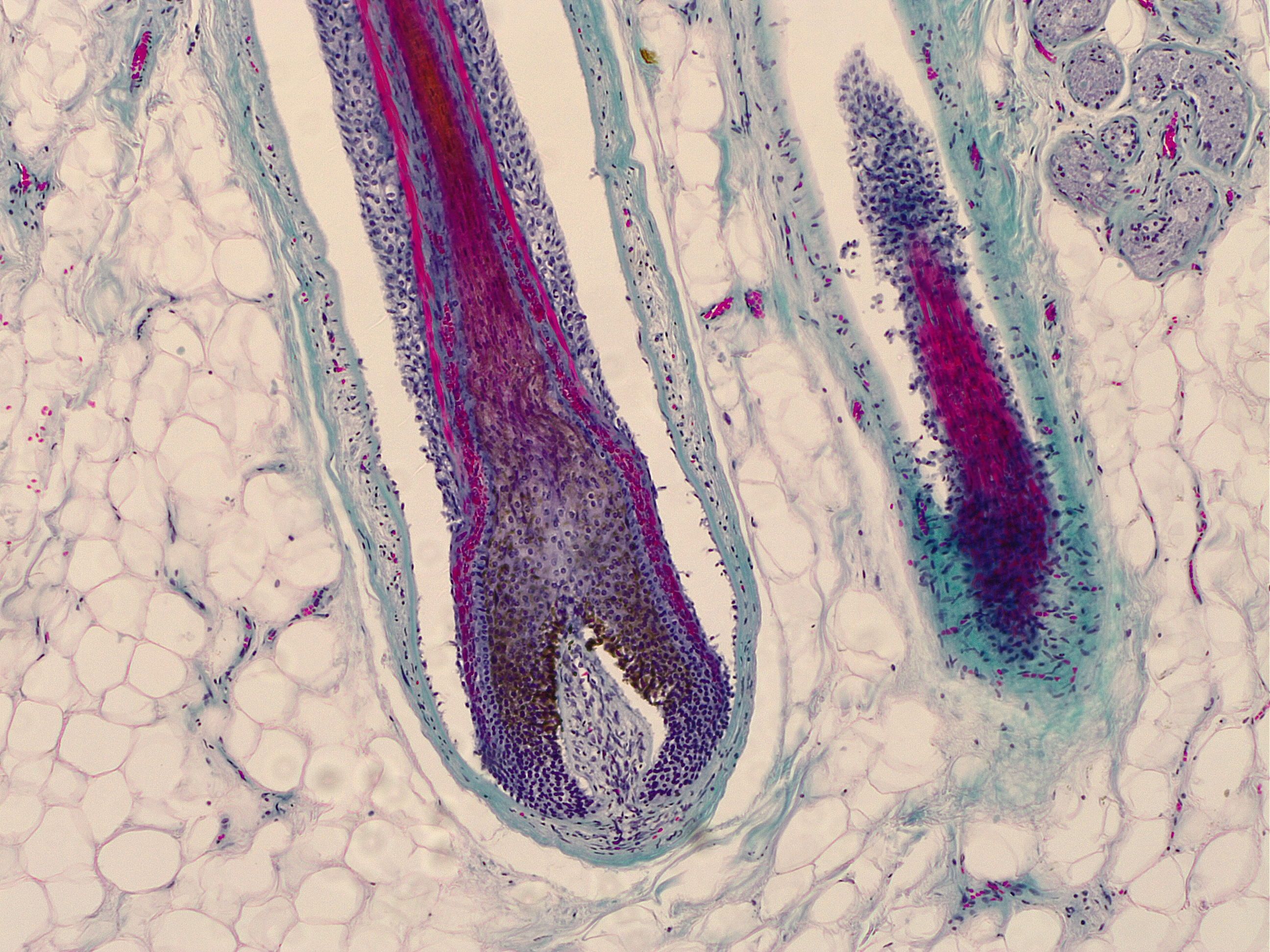 hair follicles