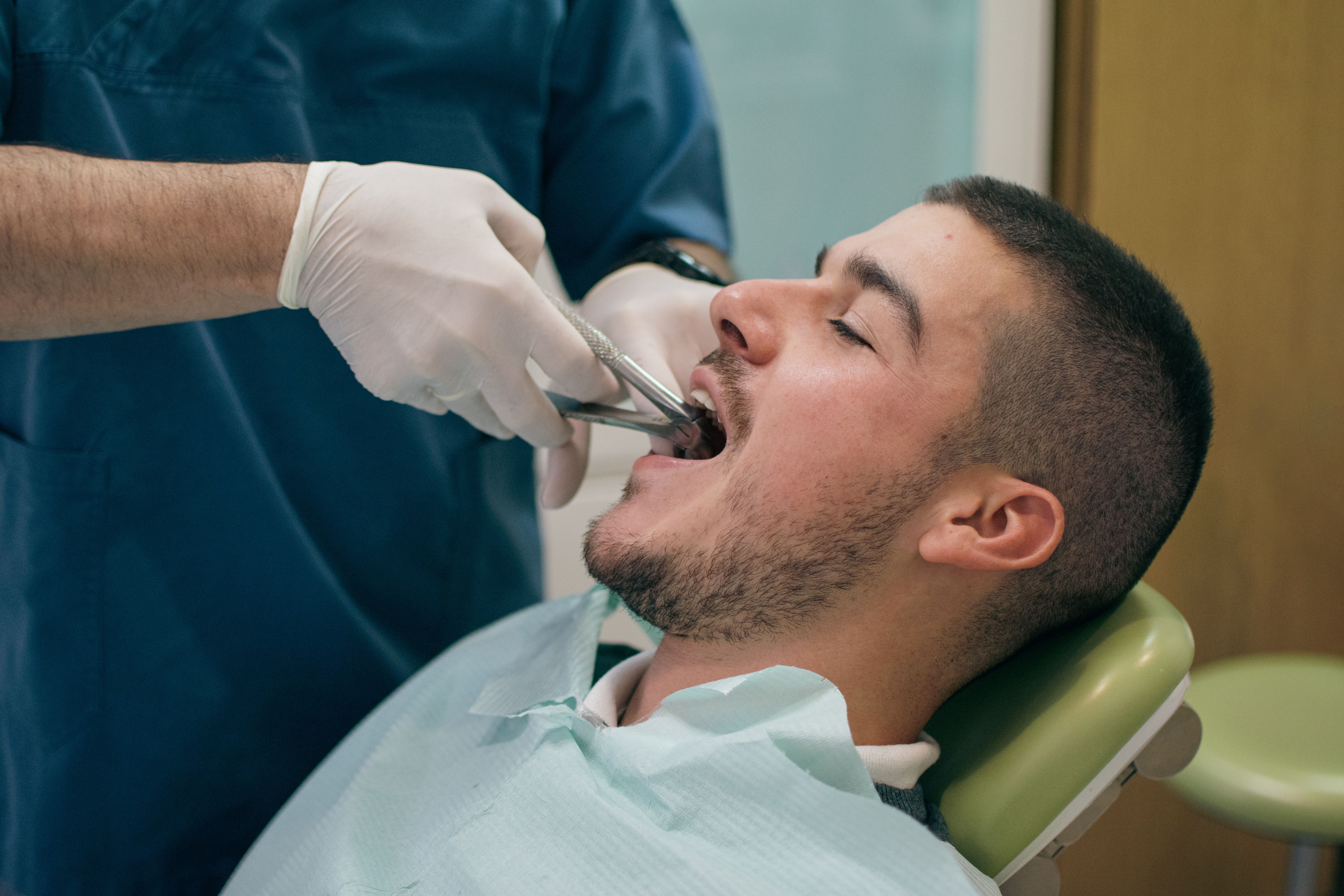 tooth extraction
