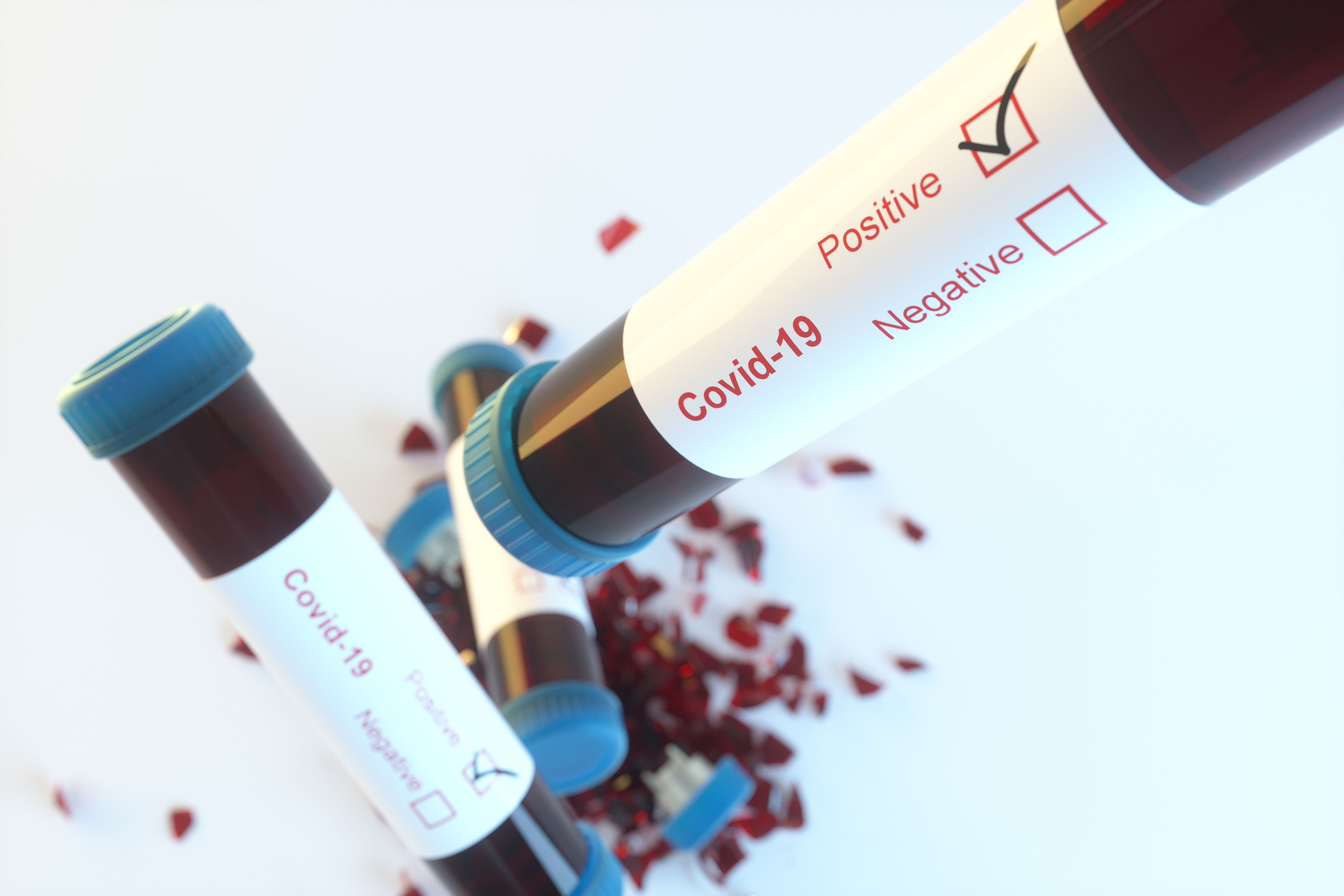 seasonal drug testing