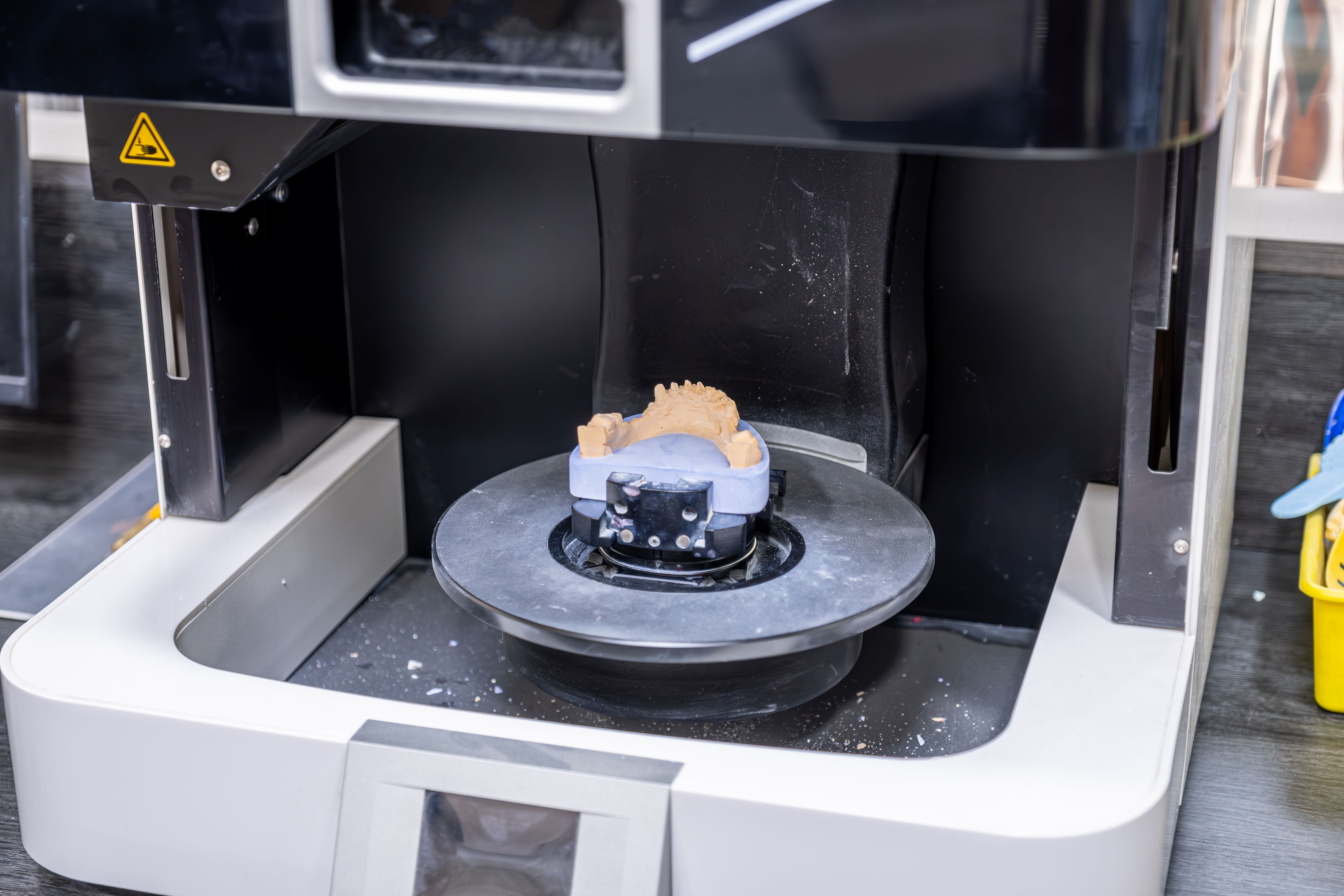 3d printer orthodontics