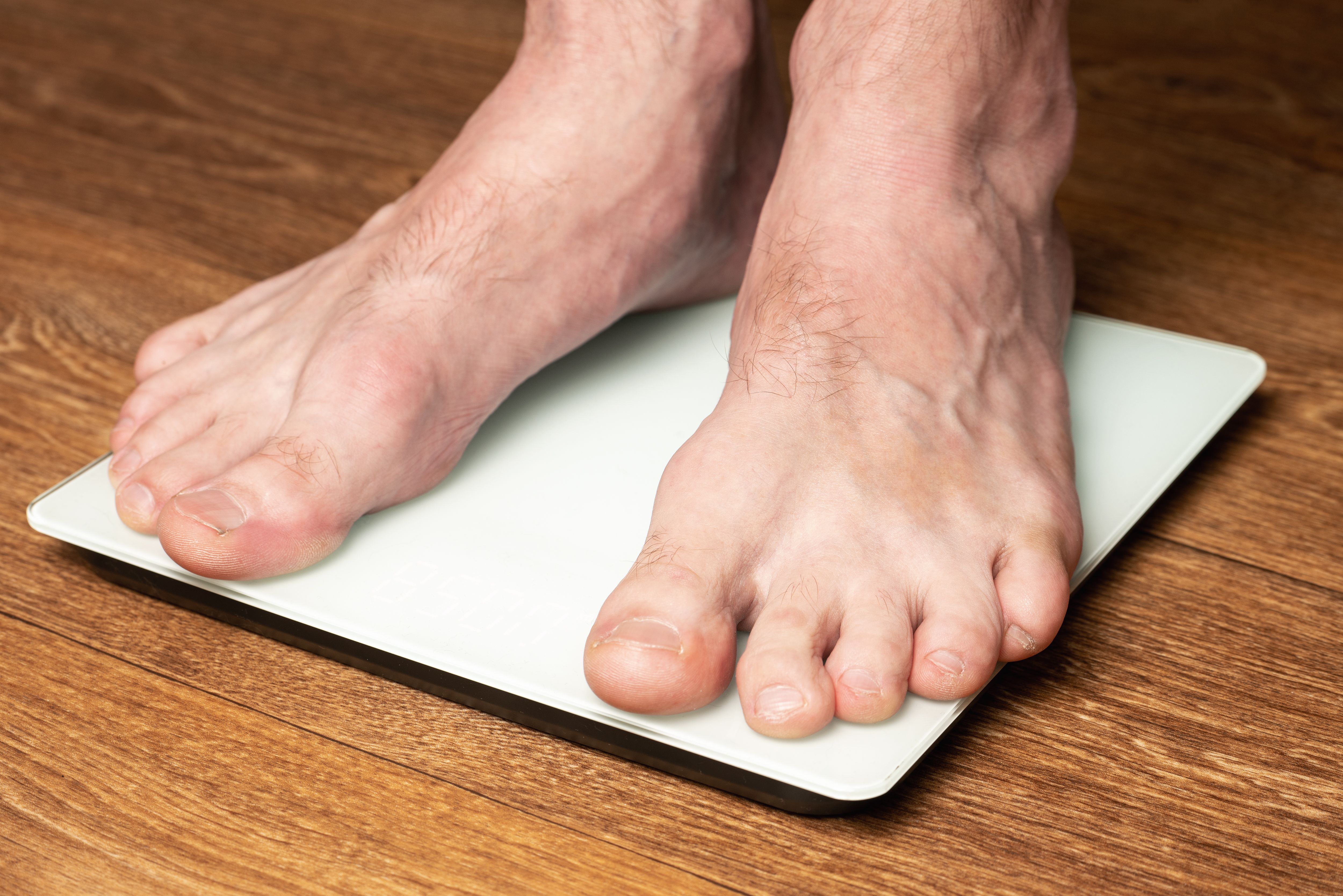 A man measures his weight by standing on a floor scale