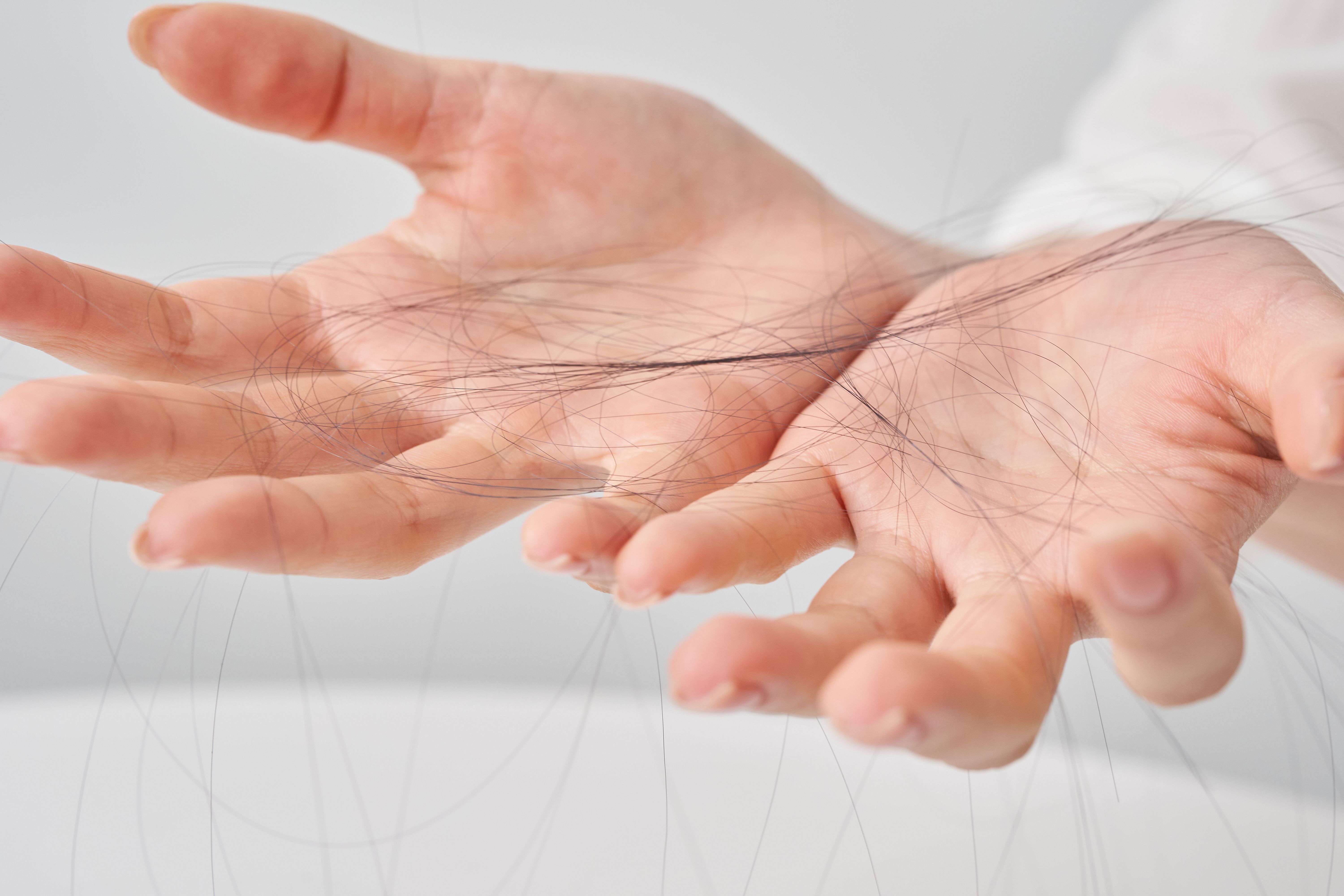 hair loss solution