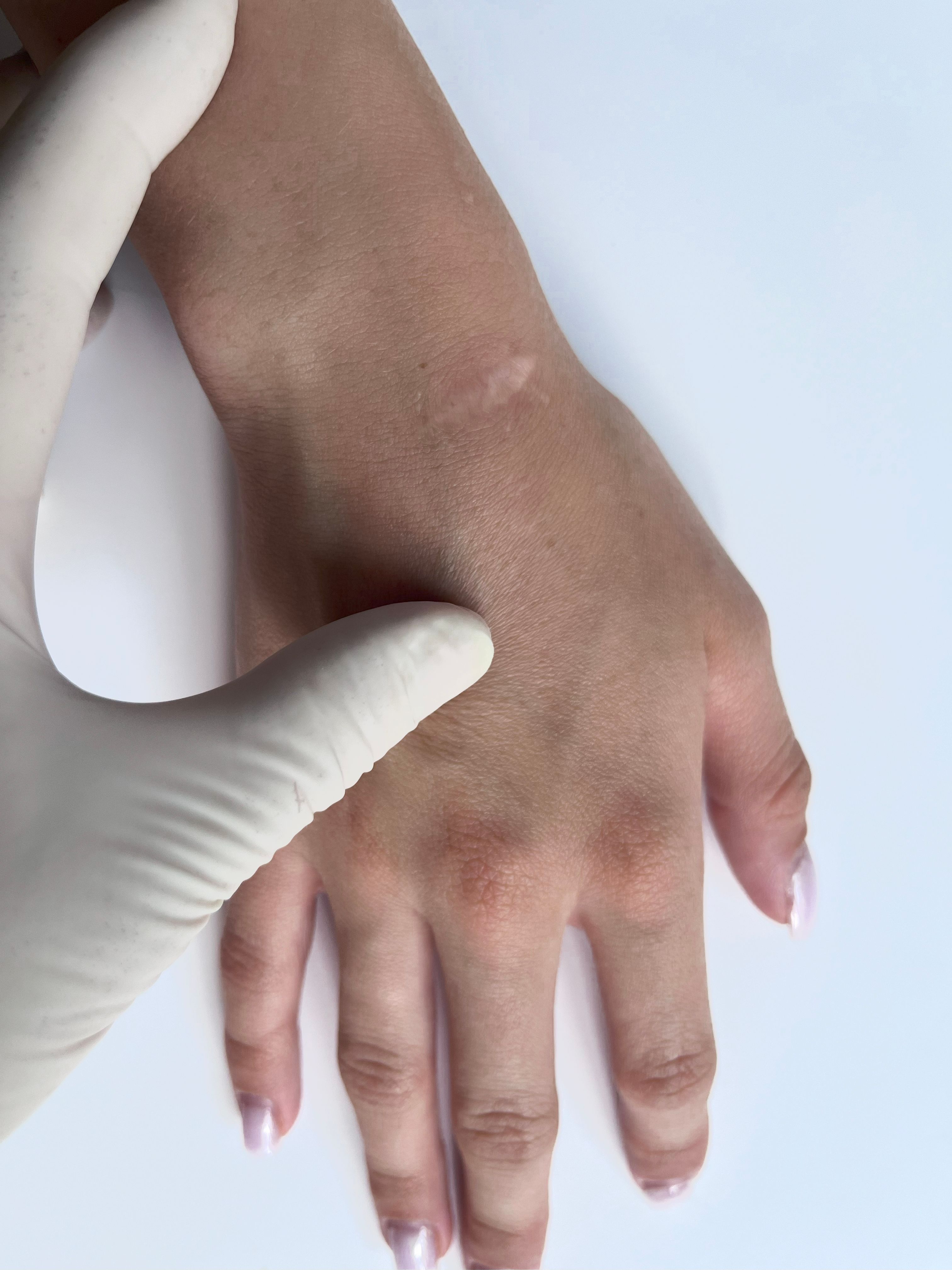 post-surgery garment