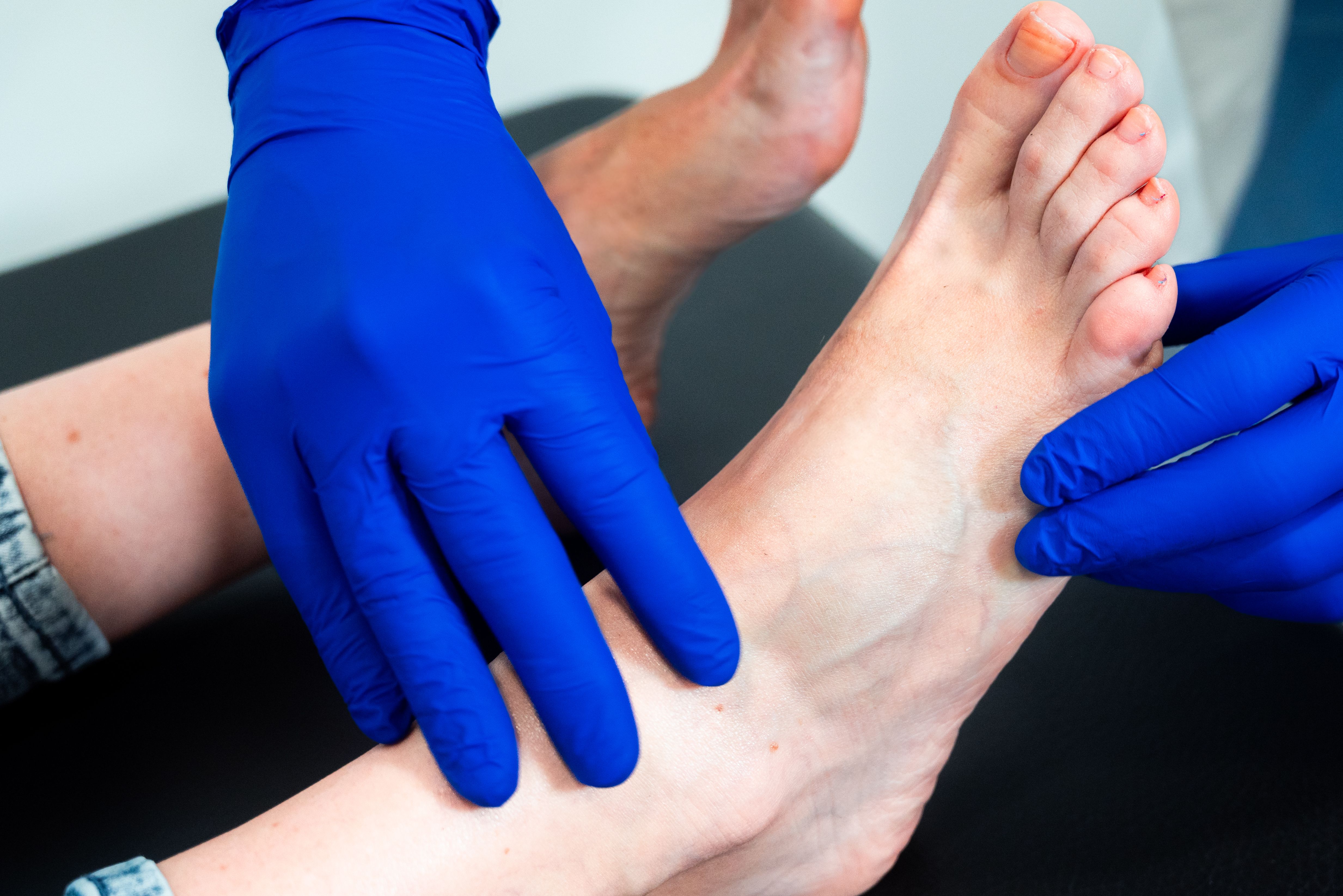 foot treatment