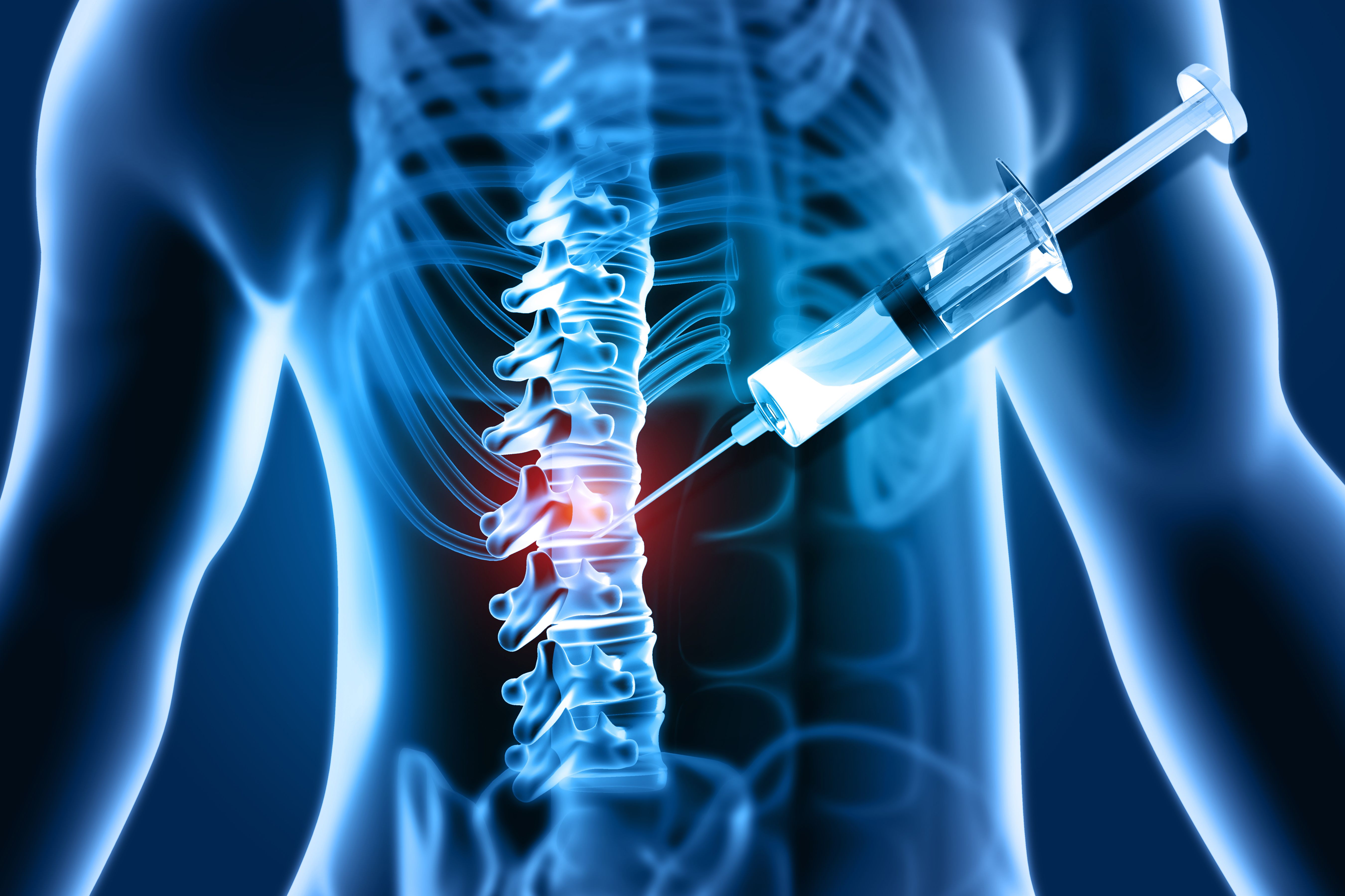 advanced spinal treatment